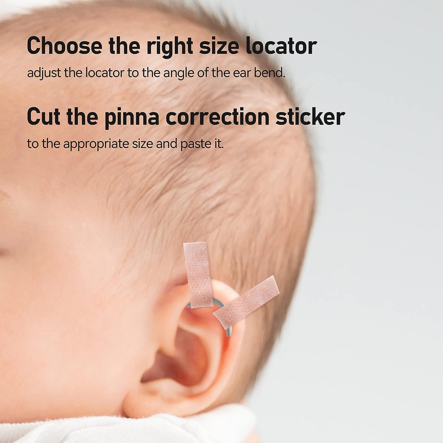 Sanfe Elephant Protruding Ear Corrector Orthopedic Baby Item for