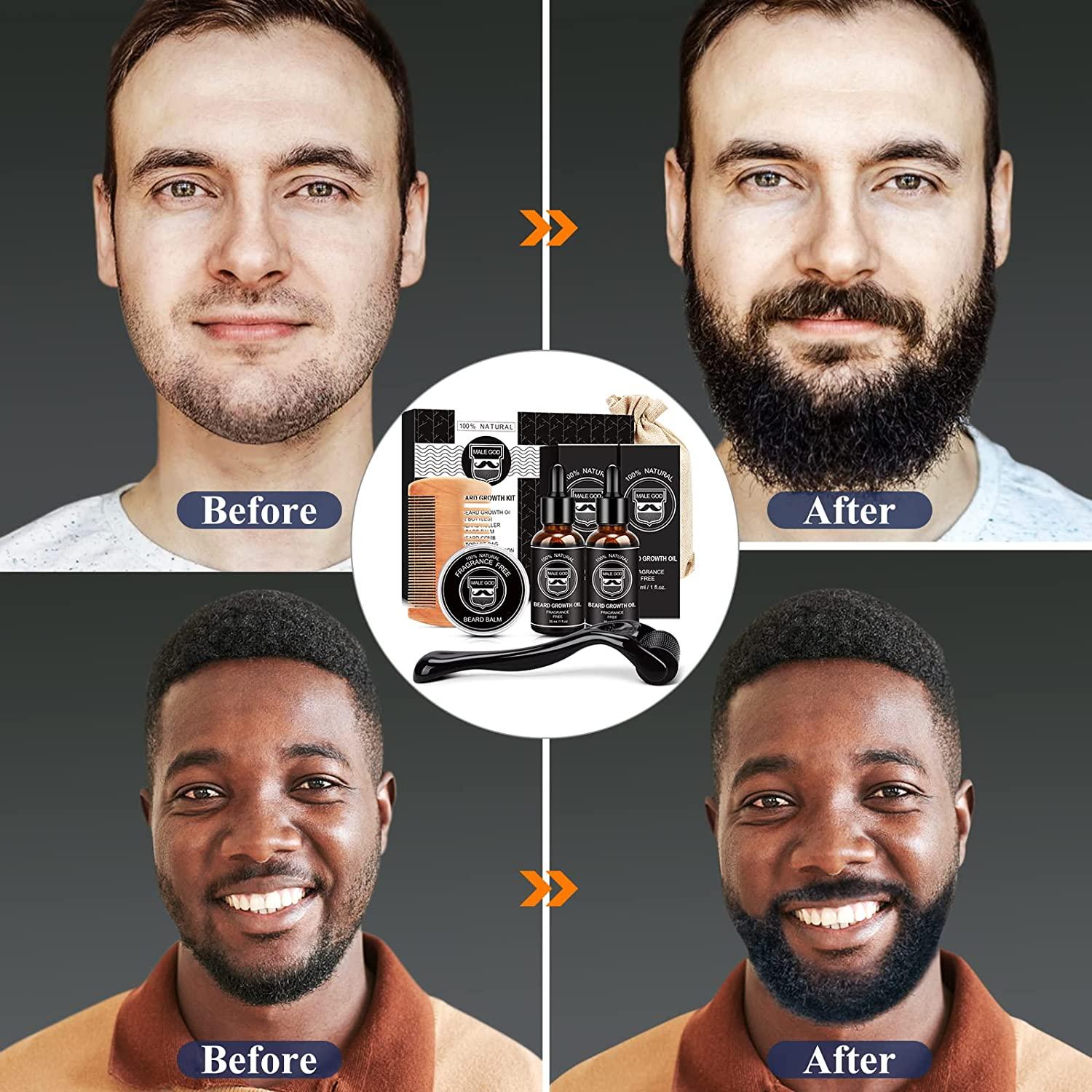 Facial hair growth products discount
