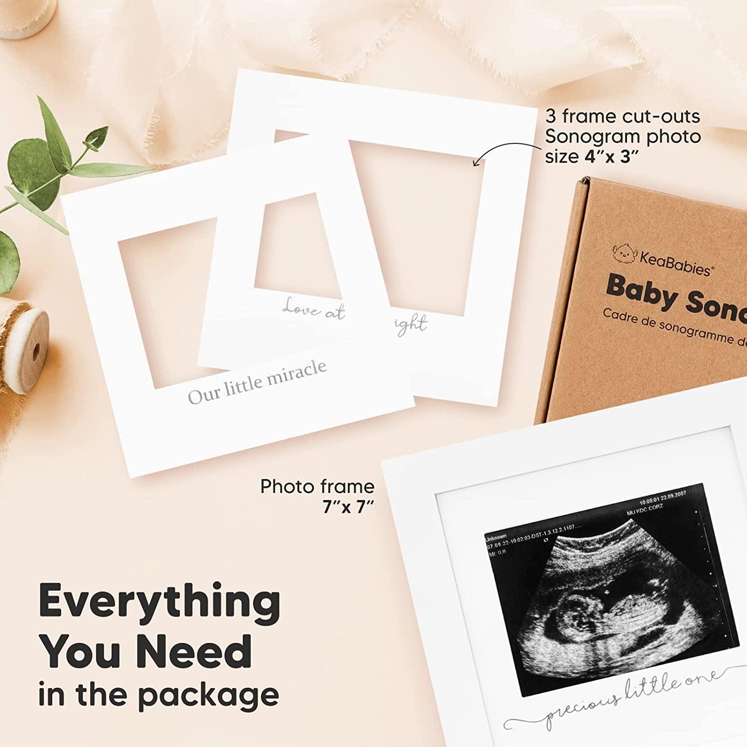 Baby Sonogram Picture Frame Modern Ultrasound Frame For Mom To
