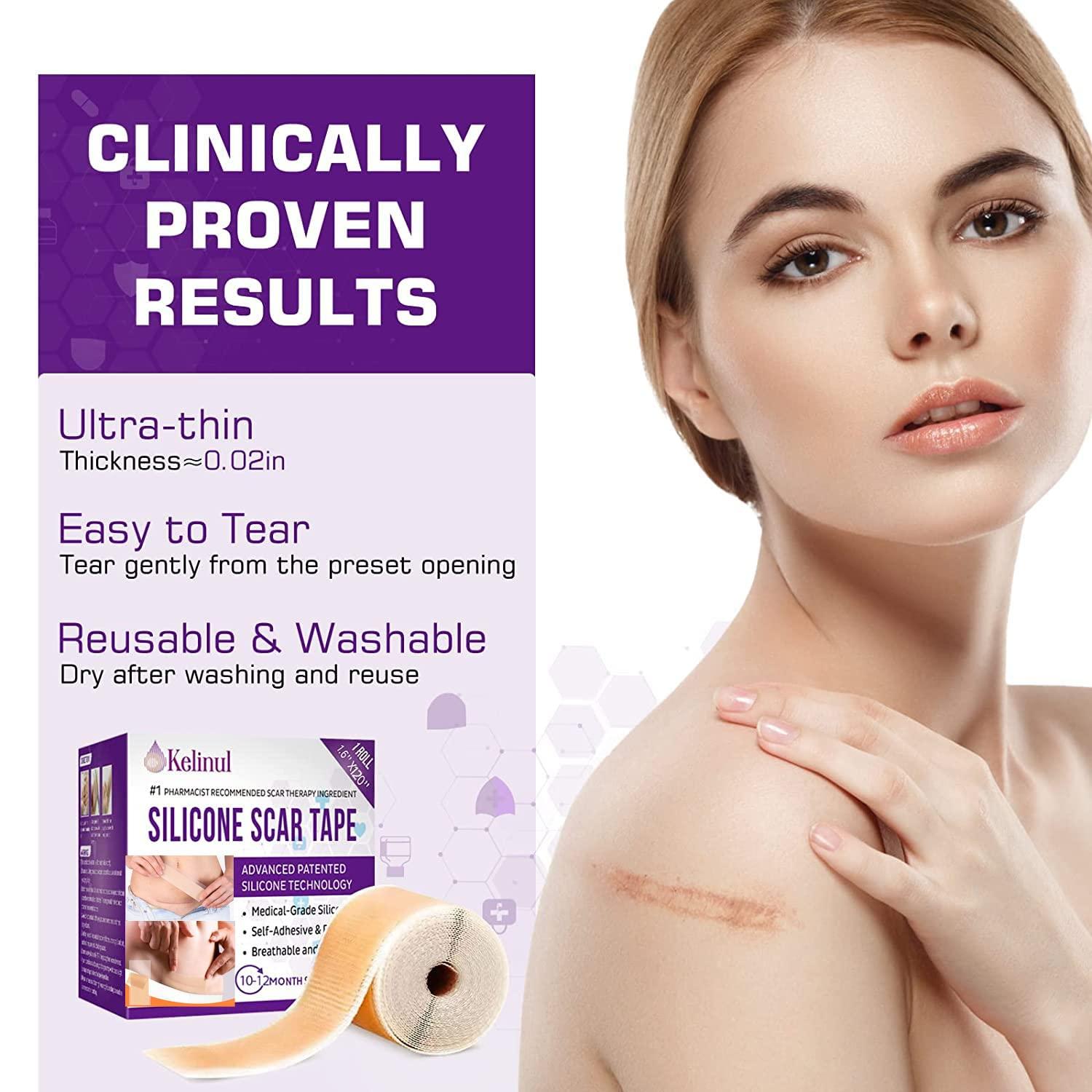 Silicone Scar Sheets (1.6 x 120 Roll) 3M Scar Removal Tape for