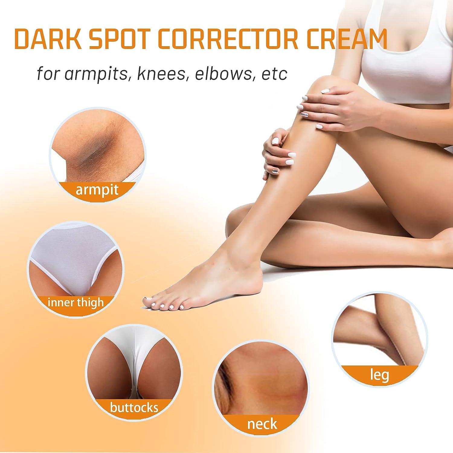 Dark Spot Corrector Cream Inner Thigh Dark Spot Remover Dark Spot
