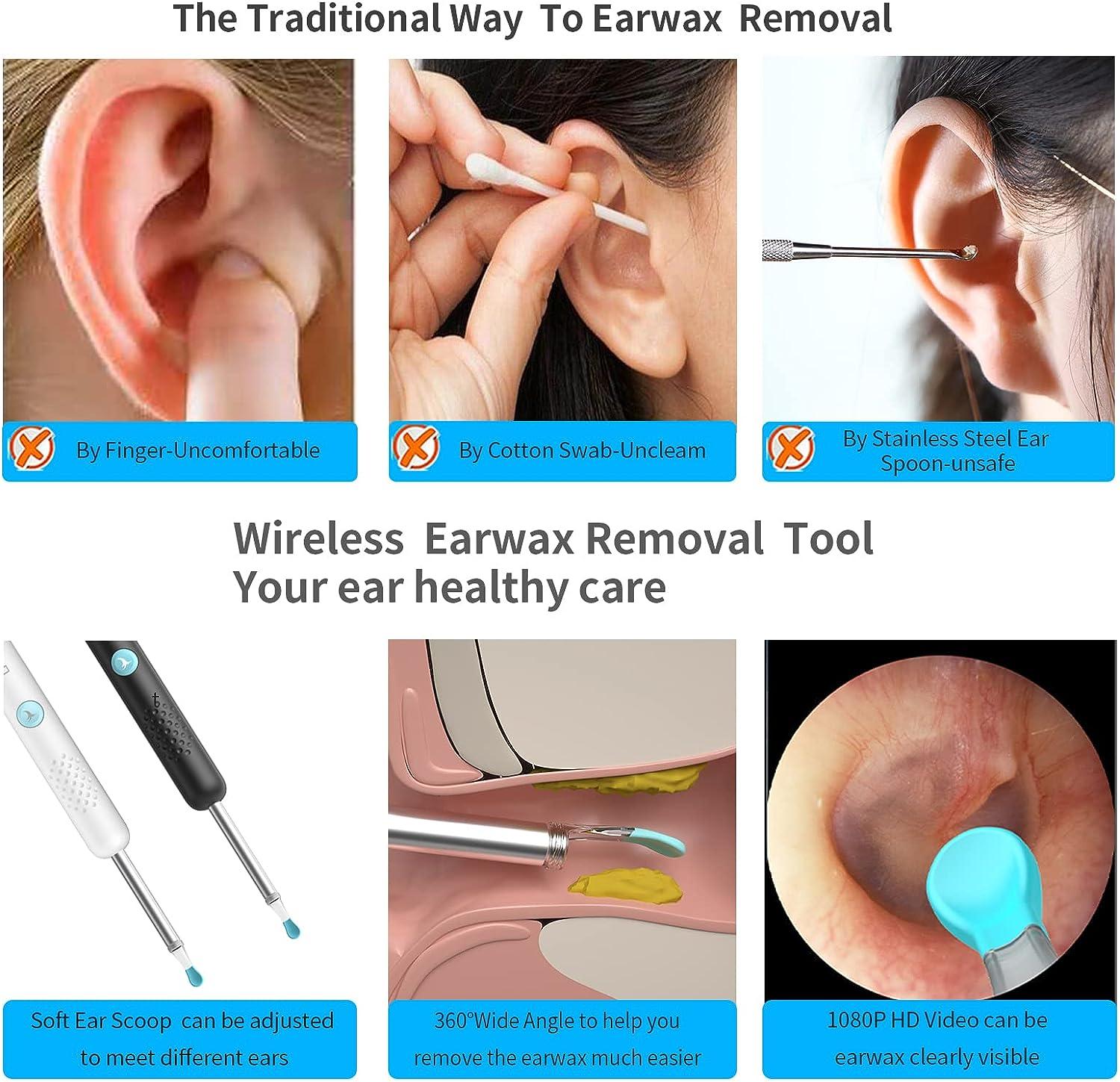 Intelligent Visualization HD Ear Scoop Ear Cleaner Tool Ear Wax