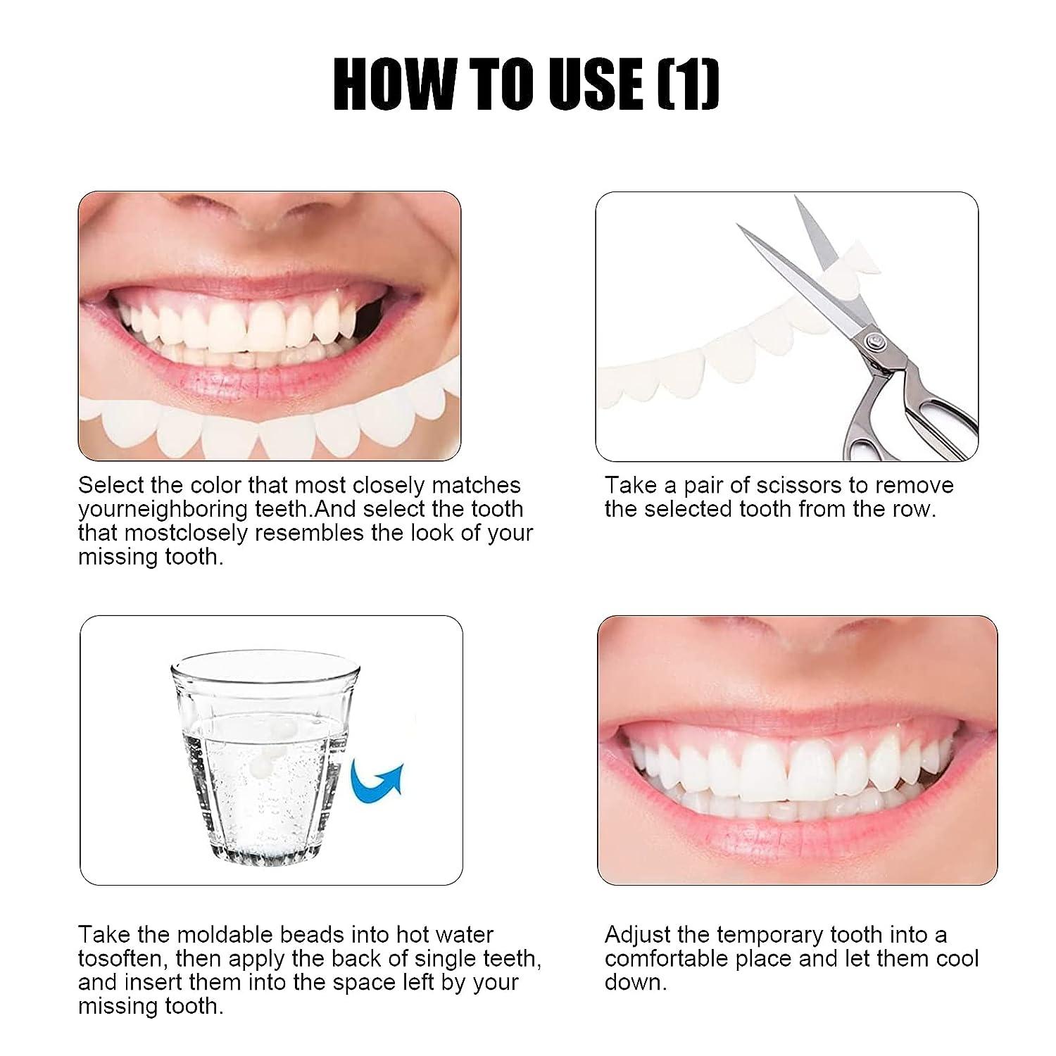 Tooth Repair At Home