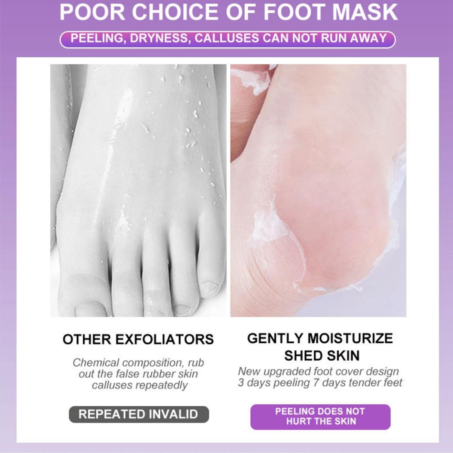 Chemical Peel Dead Skin Cells On Feet Baby Foot® Exfoliant Foot