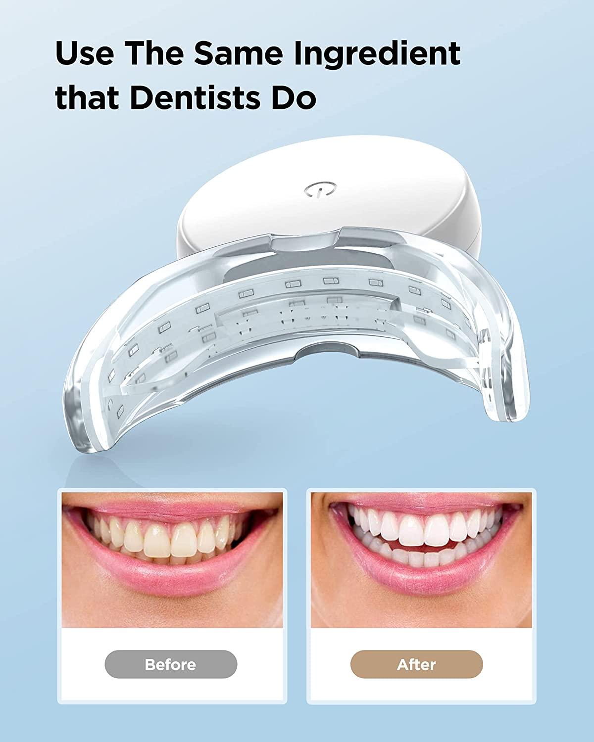 Teeth Whitening Strips with Light 28 DentistLevel White Strips for