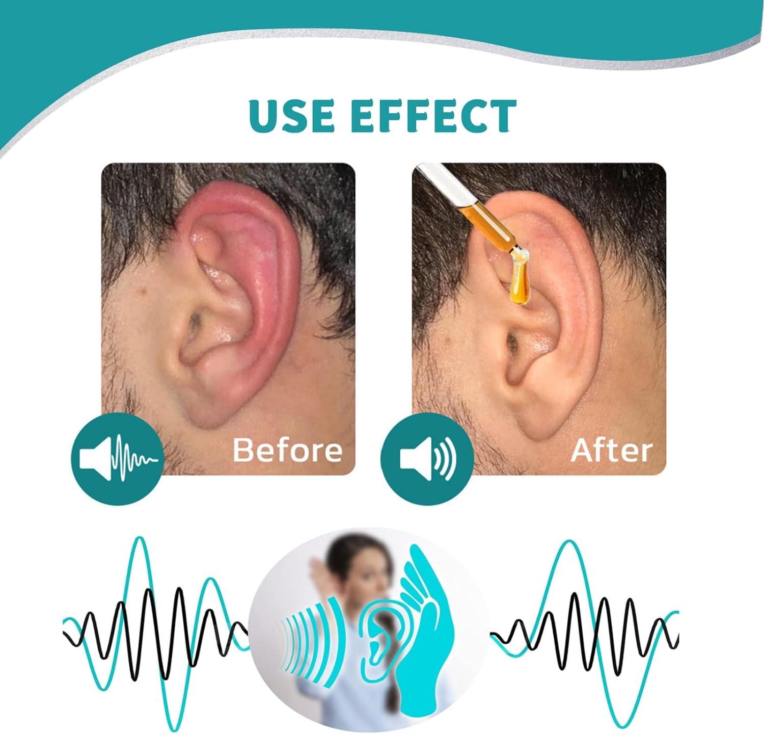 Summertime Ear Pain: Swimmer's Ear or Ear Infection? | Dr. Seemab Shaikh,  Pune