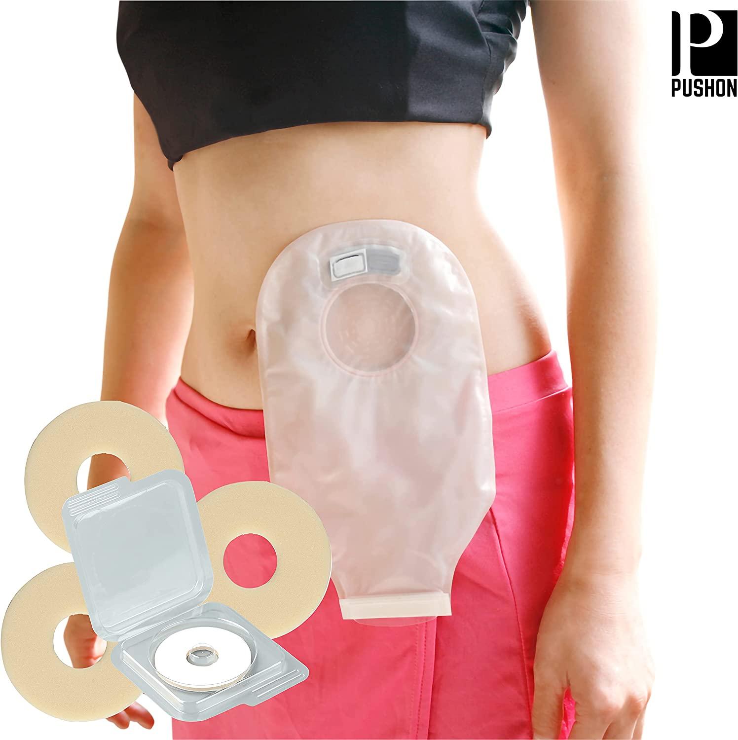 What you need to know about ileostomy/colostomy bags and stomas | Metro News
