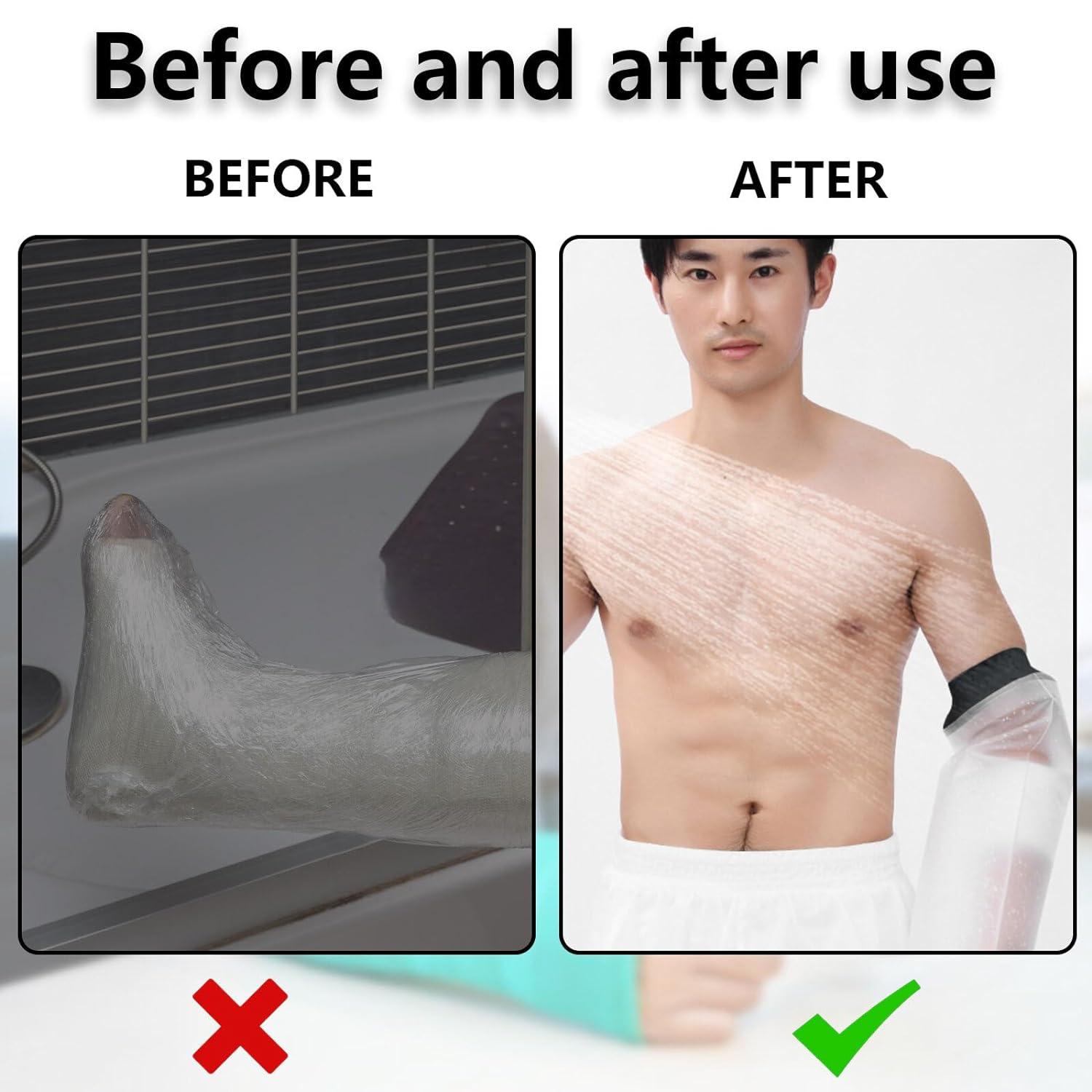 Waterproof Arm Cover for Shower 30cmx22cm Waterproof Cast Cover Arm