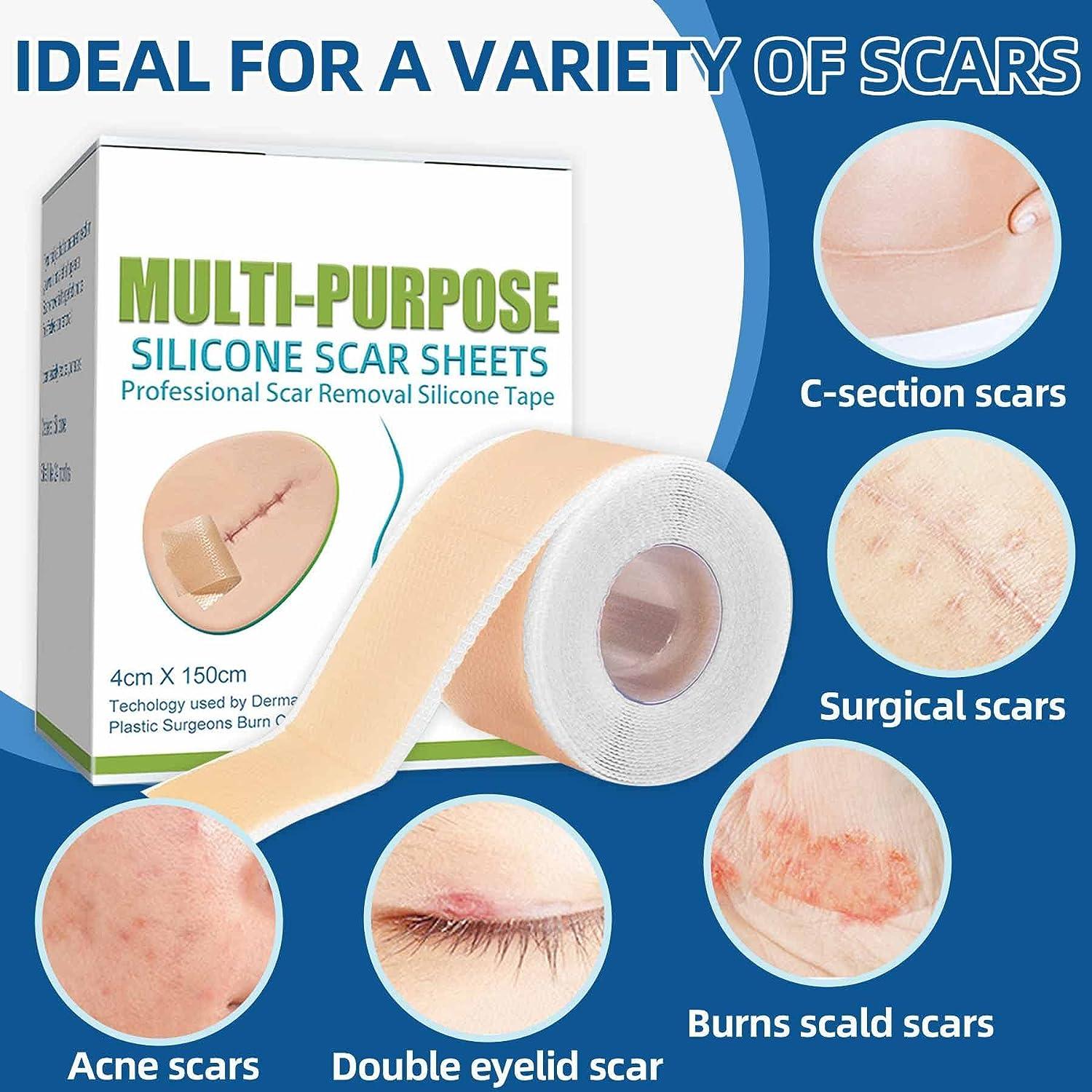 Silicone Scar Sheets (1.6 x 60 ) Scar Reducing Silicone Scar Sheets