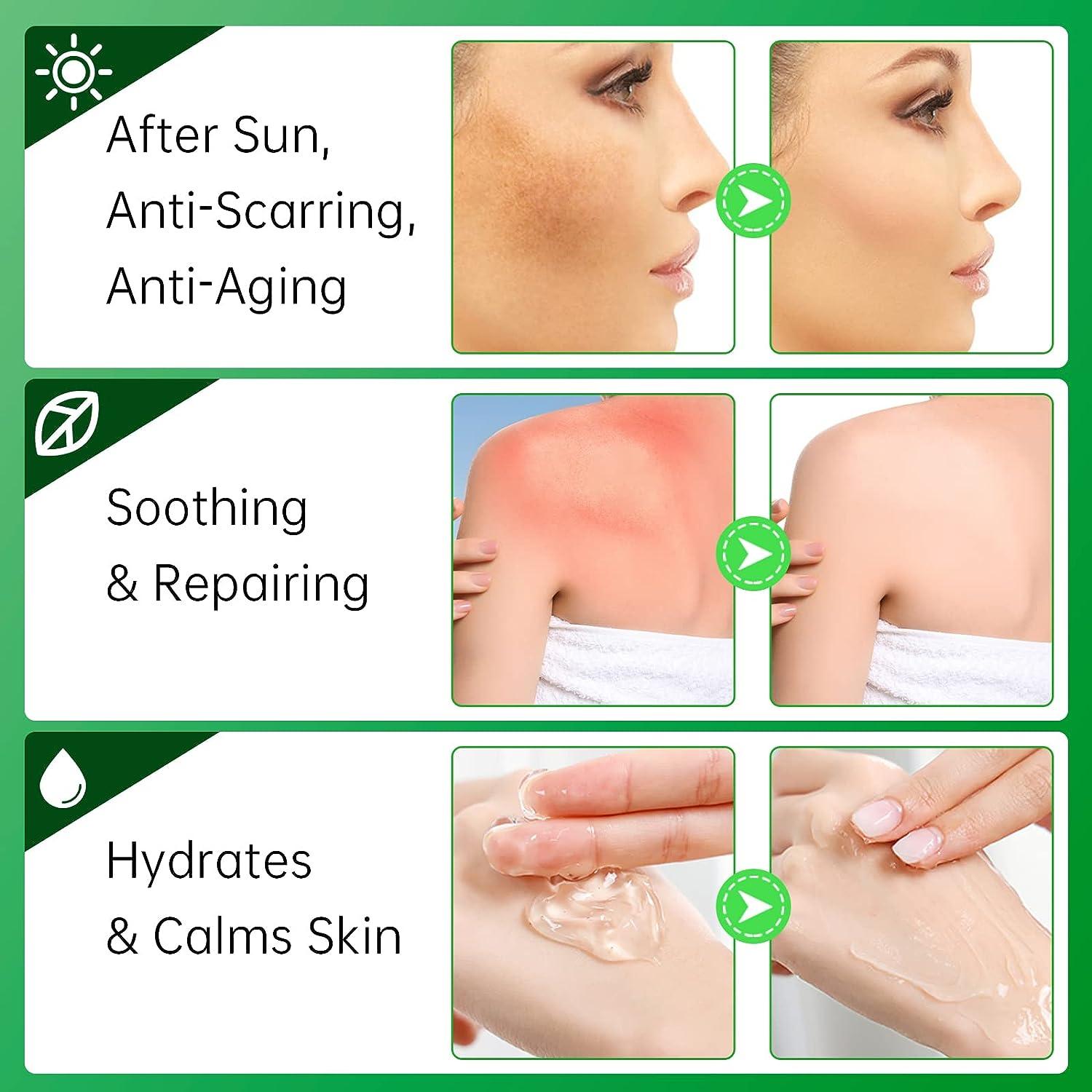 Aloe Vera Moisturizer for Face - Skin Repair, Sunburn Relief | Anti-Scarring  & Aging | ECO-FRIENDLY & CRUELTY-FREE | Buy Now with Express International  Delivery | GoSupps.com