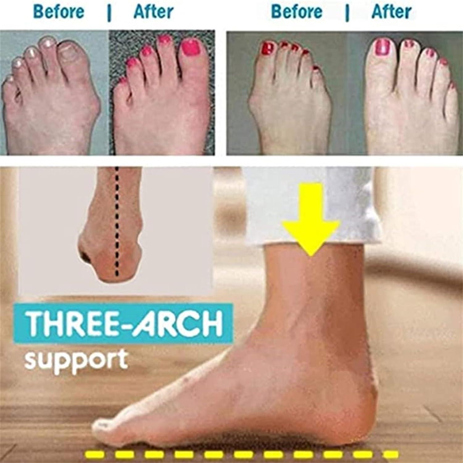 Shop Comfy Bunion Sandals for Women Summer Orthopedic Open Toe