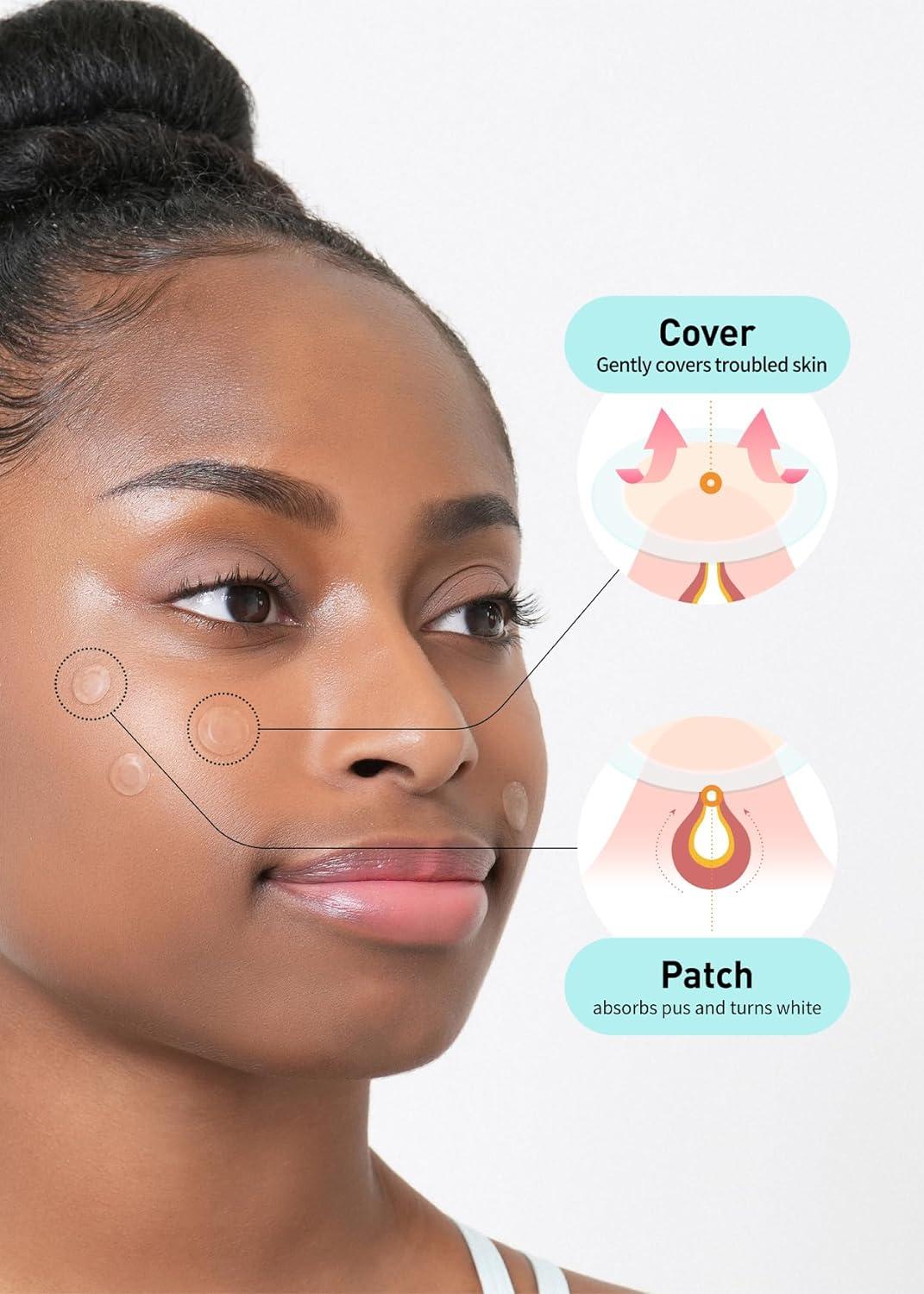 Olive Young Care Plus Spot Patch Big (81 Count) | Hydrocolloid Acne Pimple  Stickers - 81 Count | Buy Now with Express International Delivery