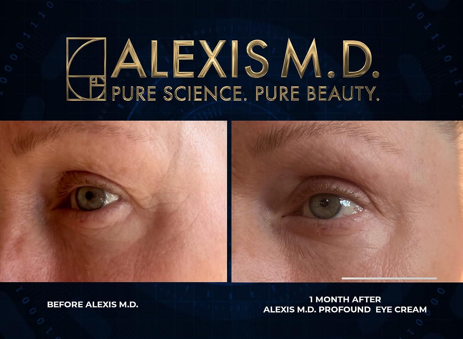 ALEXIS M.D. Profound A Complex 1oz - L-Retinol & Glutathione Formula | Buy Now with Express International Delivery | GoSupps.com ALEXIS M.D. Profound A Complex 1oz - L-Retinol & Glutathione Formula | Buy Now with Express International Delivery | GoSupps.com
