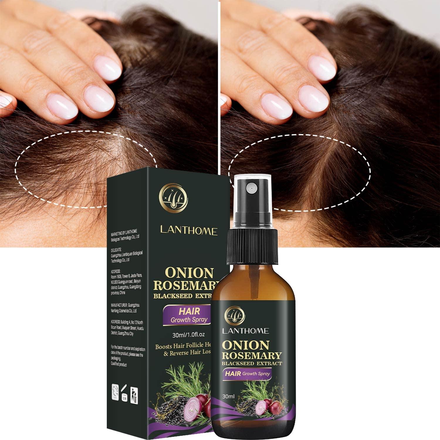 Hair Growth Spray Onion Oil for Hair Growth Organic Hair Growth Serum Enriched with Rosemary