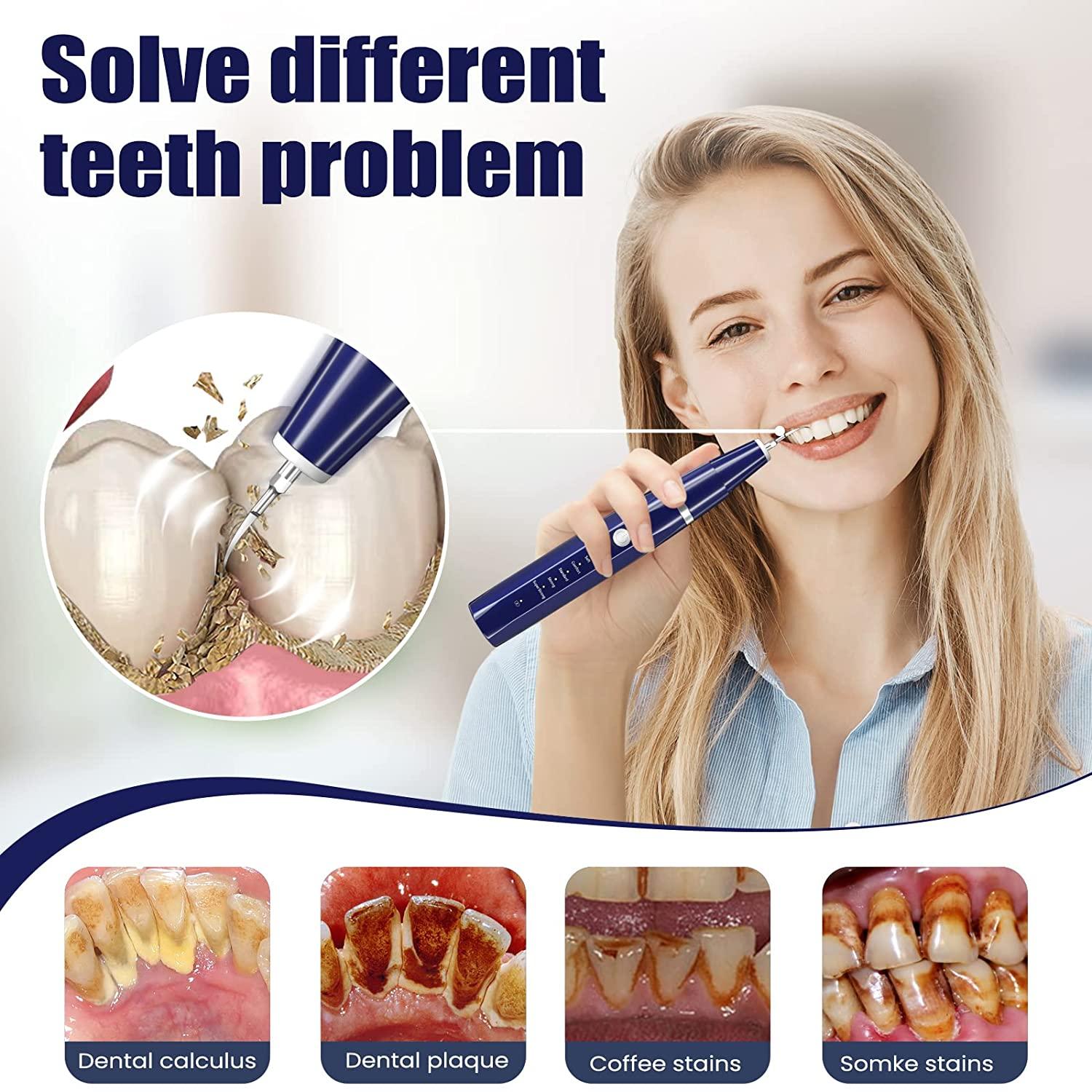 Plaque Remover for Teeth Tartar Remover for Teeth, Dental Calculus