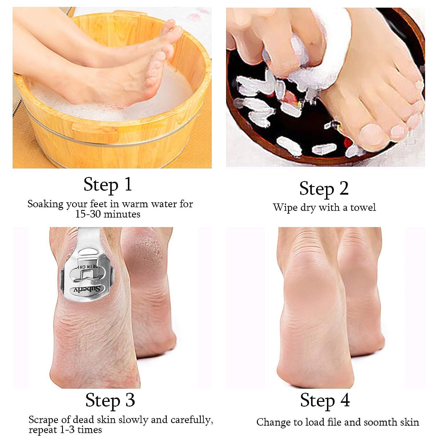 3 Foot Care Pedicure Callus Shaver Hard Skin Remover Tool Set | SM2984