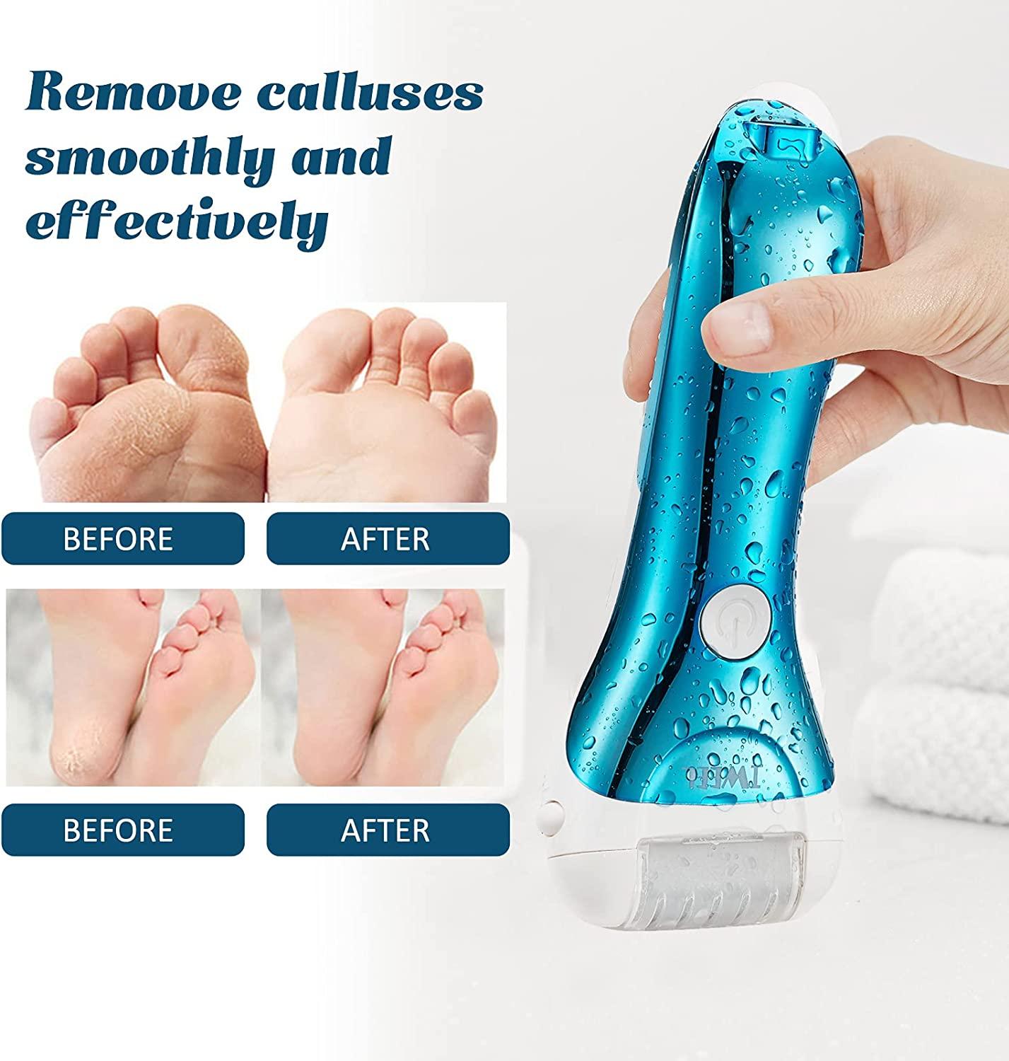 Callus Remover for Feet, Electric Foot File Rechargeable Foot Scrubber