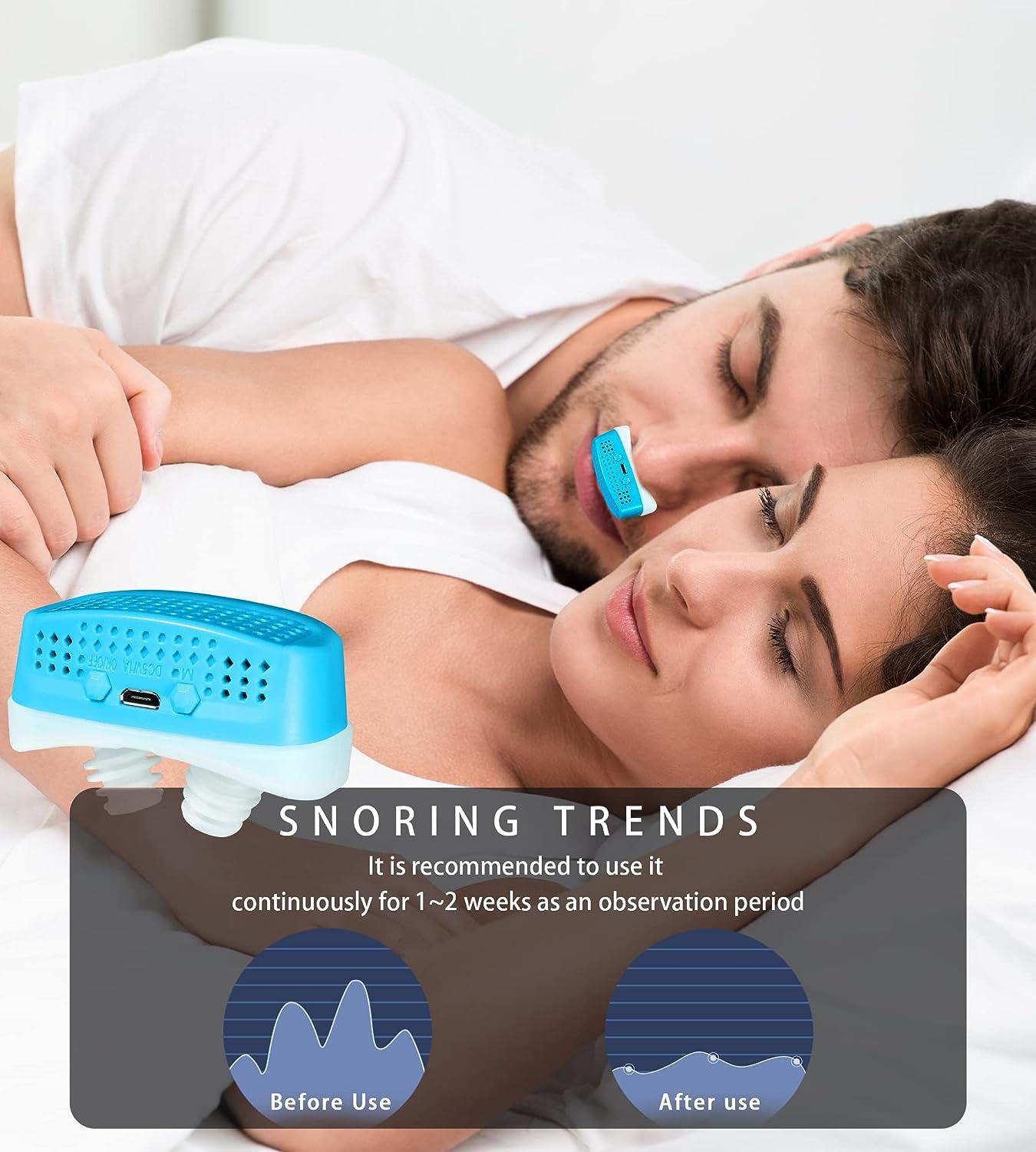 2023 New Anti Snoring Devices Variable Speed Anti Snoring Devices with