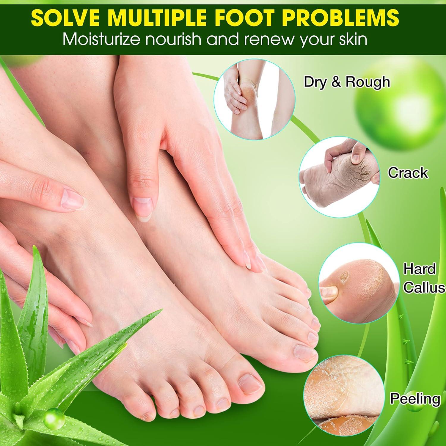 Homemade dead clearance skin foot peel
