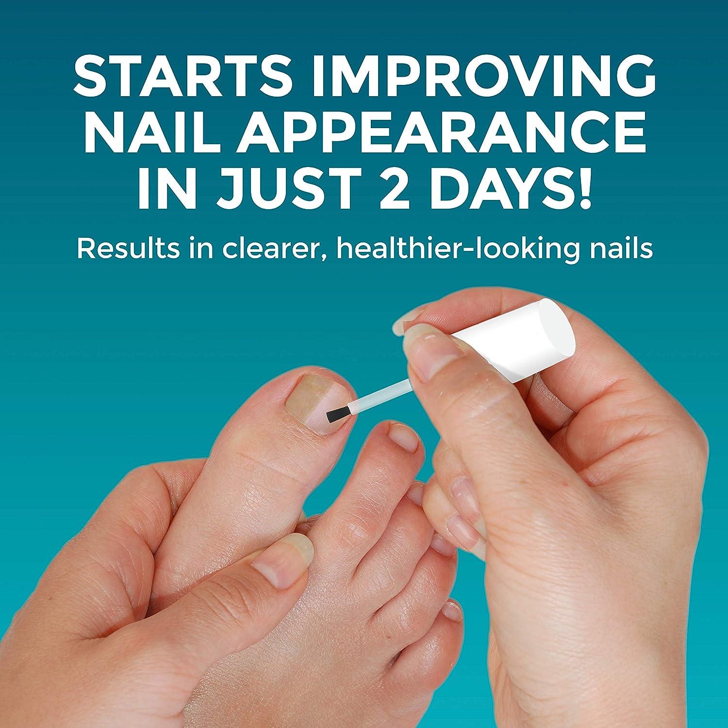 OptiNail Fungal Nail Repair with Brush Applicator Restores the Healthy