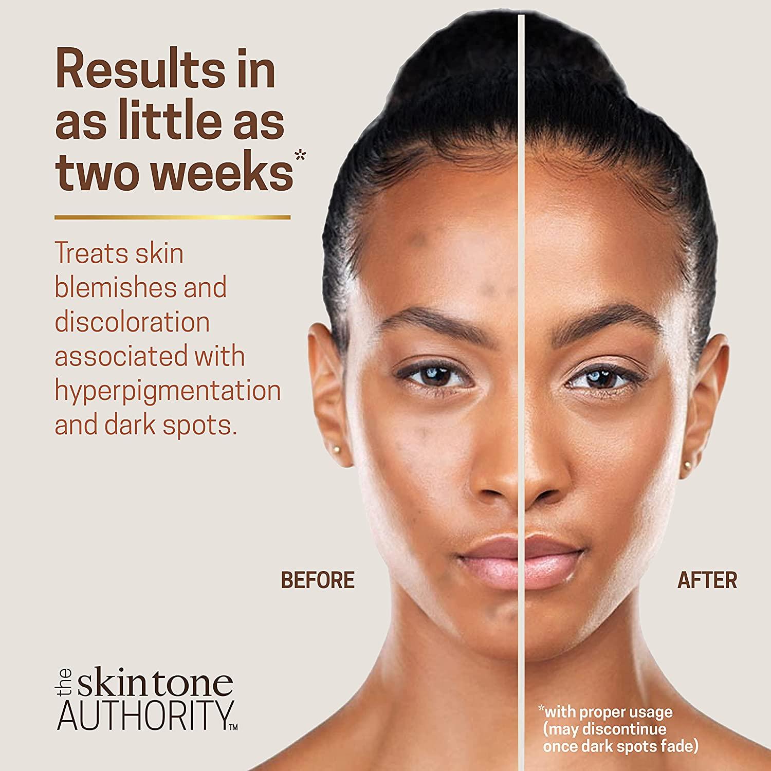 Ambi skincare fade store cream