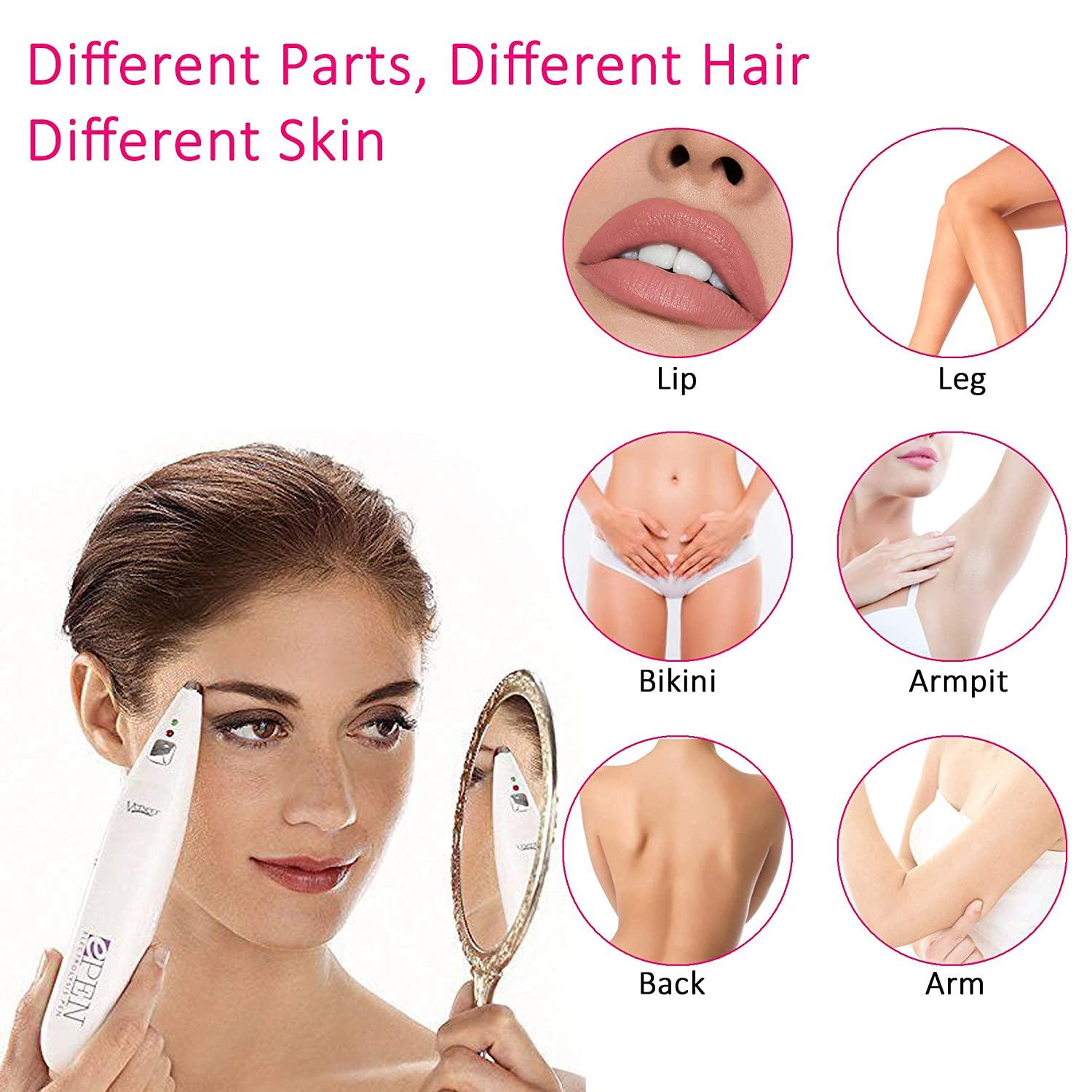 Verseo ePen NeedleFree Electrolysis for Permanent Hair Removal Face