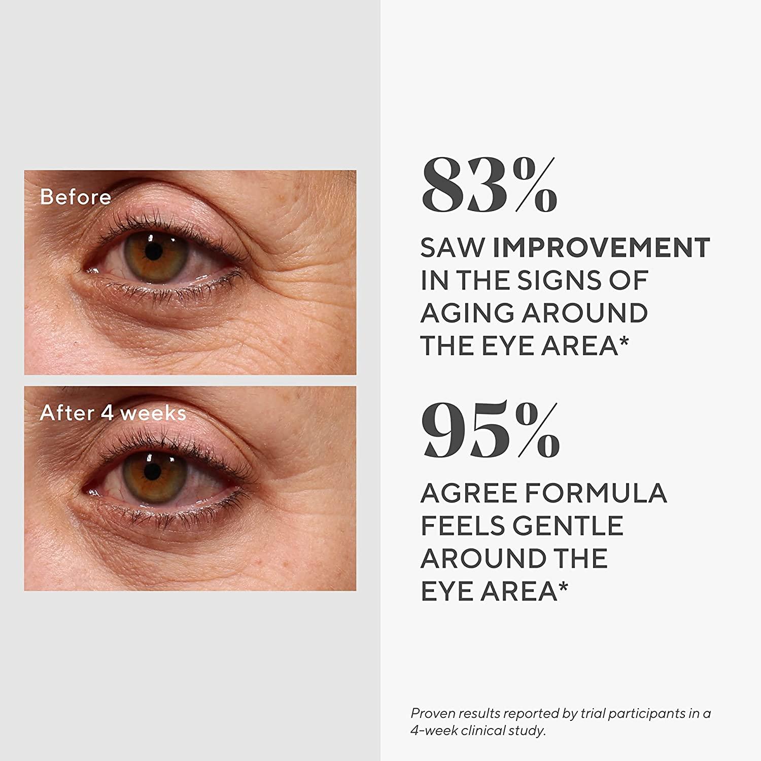 Murad Resurgence Retinol Youth Renewal Eye Serum AntiAging Skin Treatment for Crows Feet