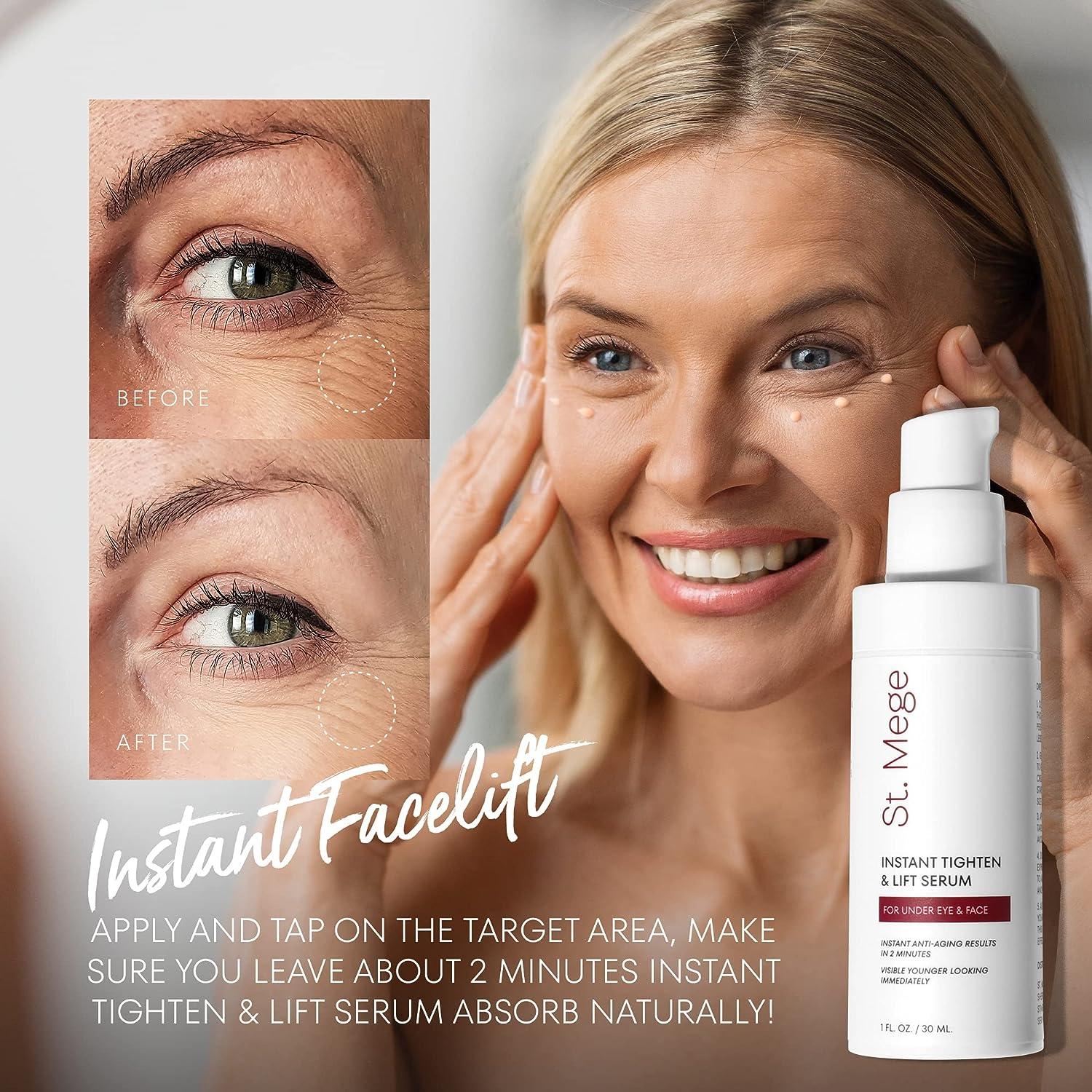 The Instant Facelift.