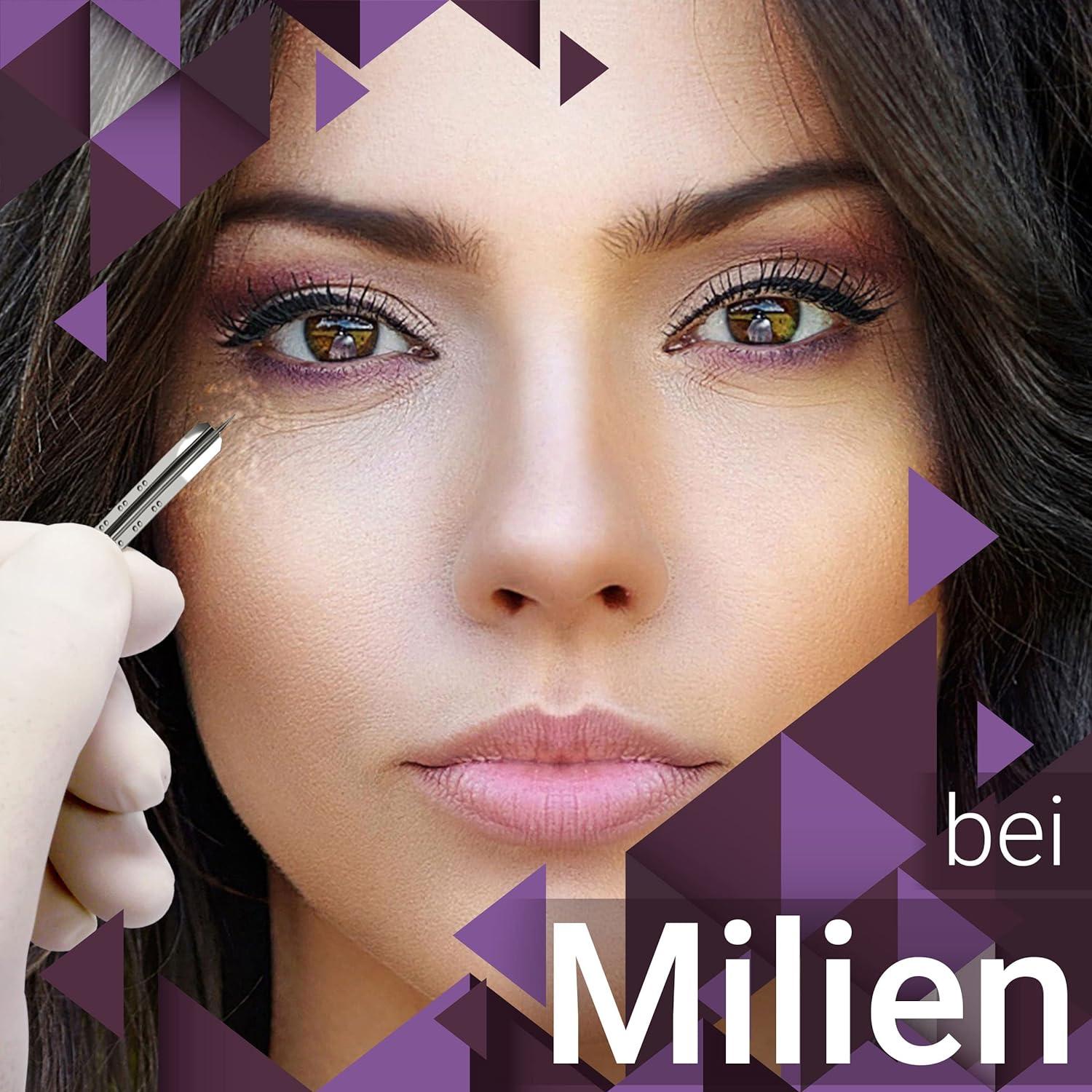 200 x Milia Lancets Lancets Sterile Pointed Kosmetex Blood Lancets