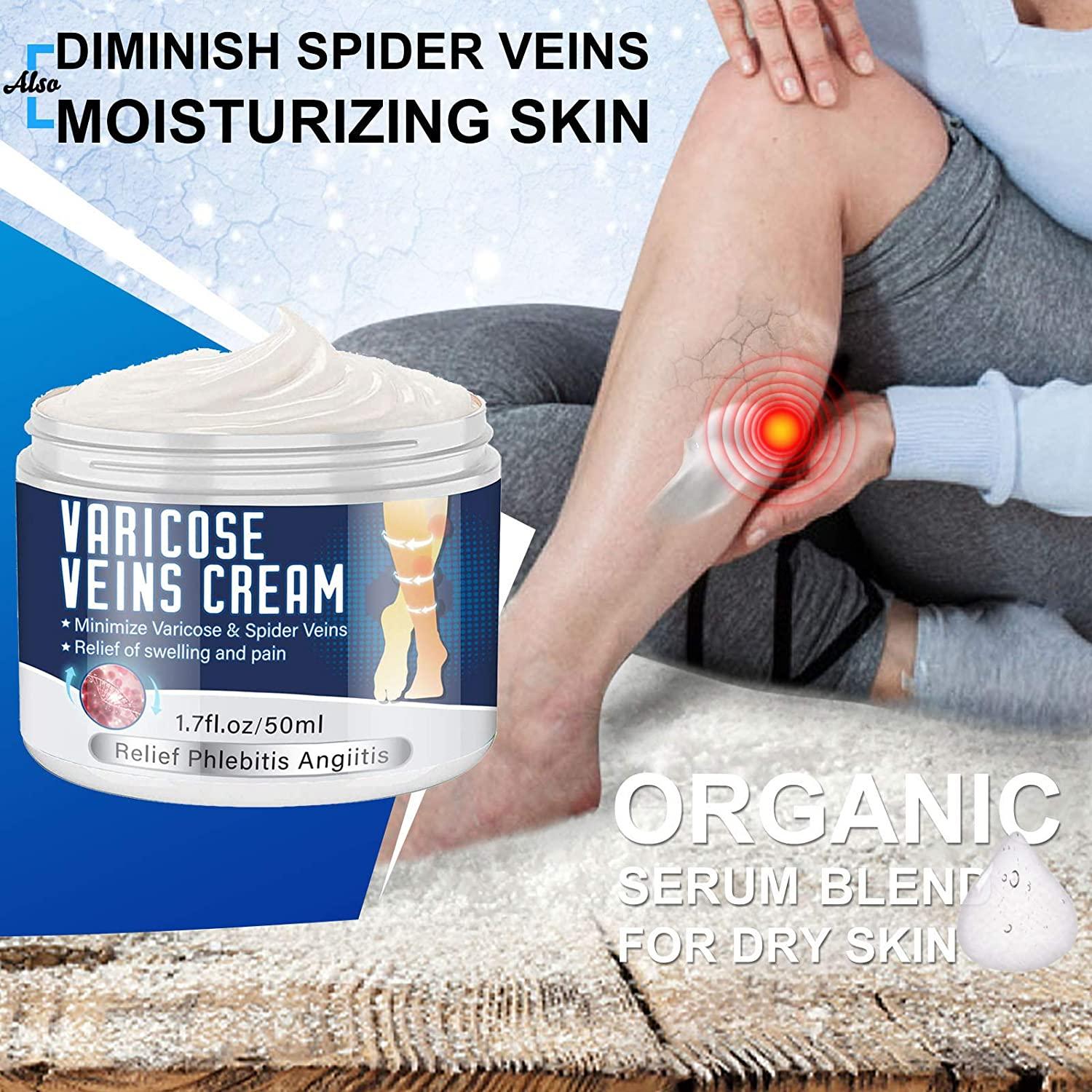 Varicose Veins Cream, Veins Treatment Cream for Legs, Natural Extract
