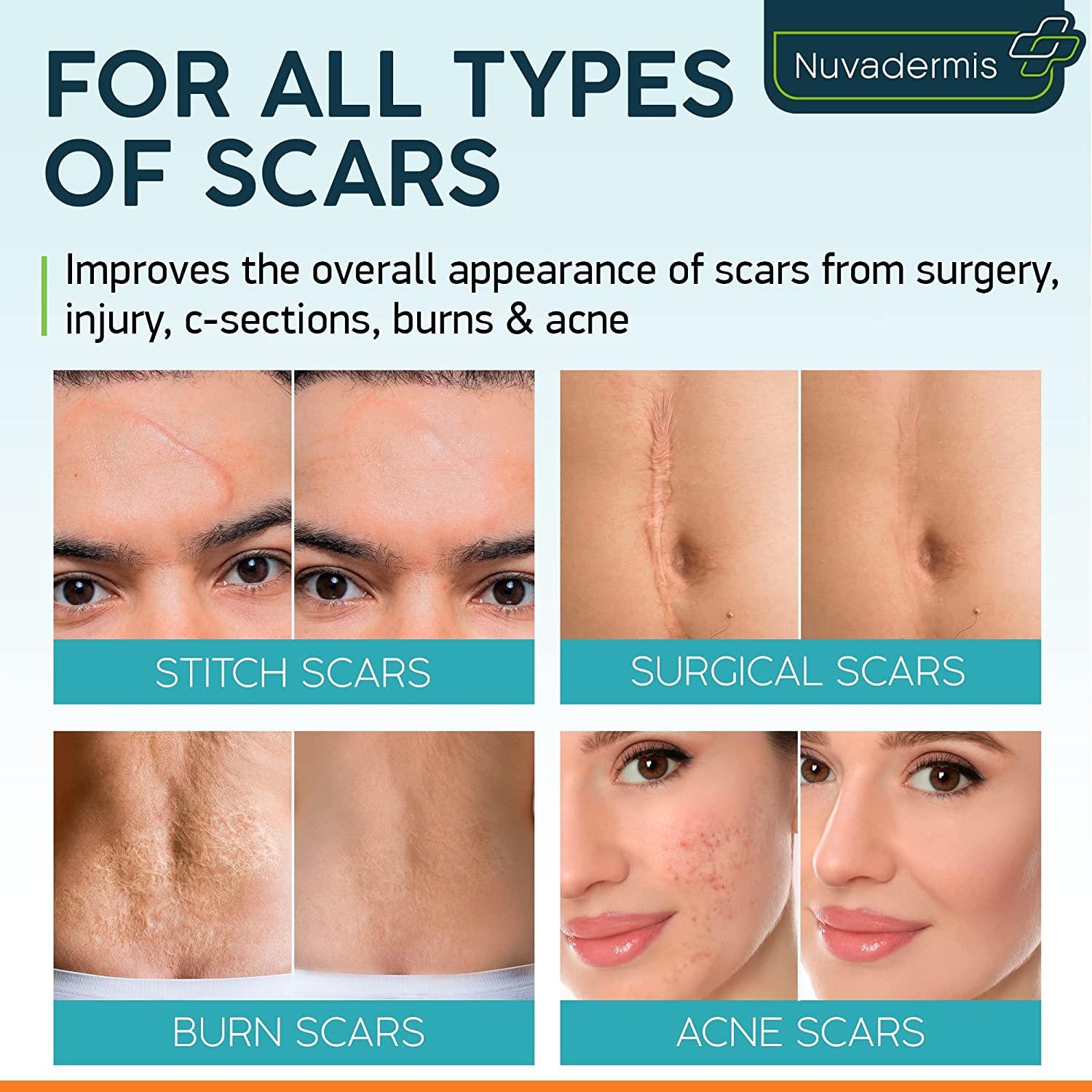 Scar Cream Gel with Retinol, Allantoin, Vitamin E, Betaine Post