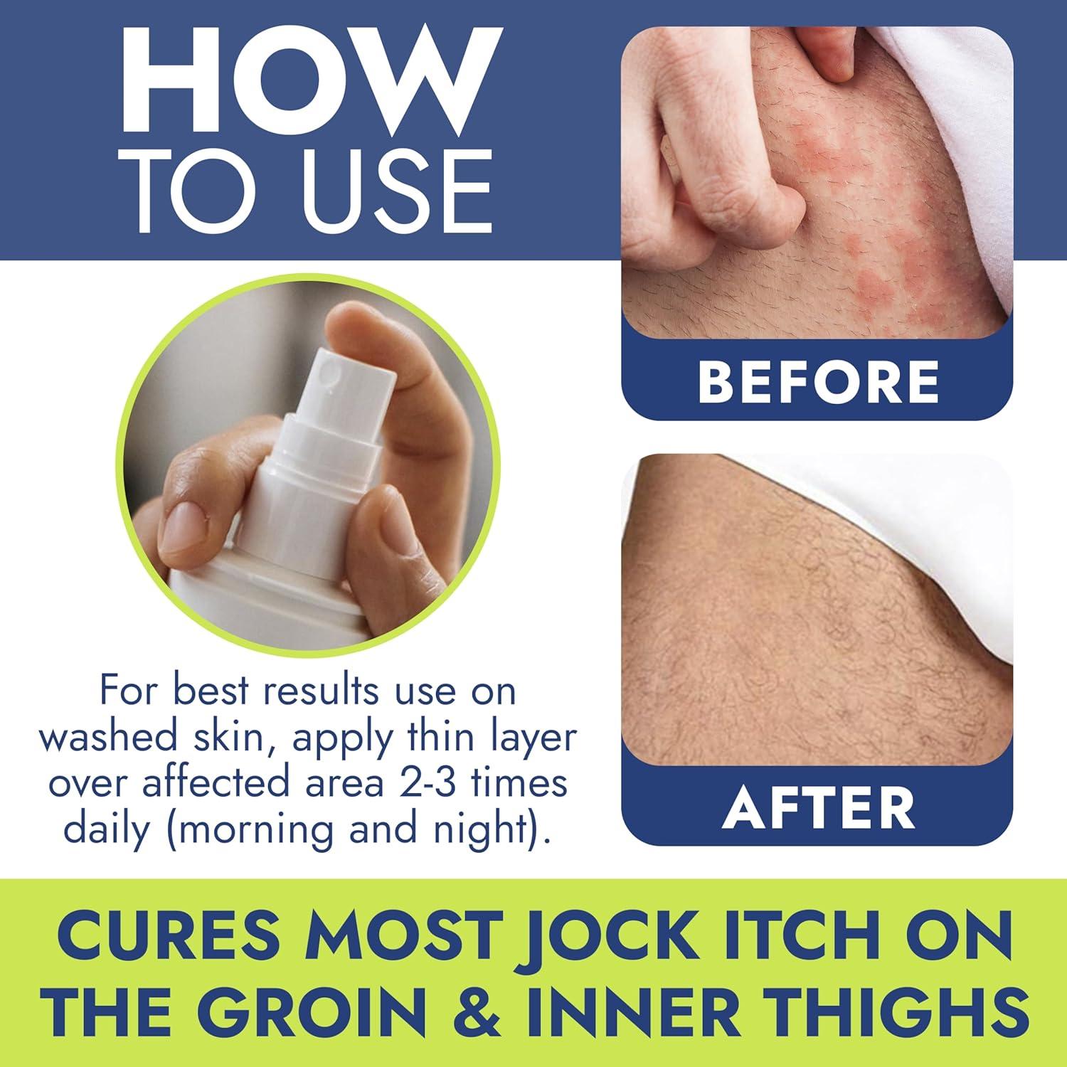 Terramed Just Think Comfort Jock Itch Spray Fast-Acting Itching