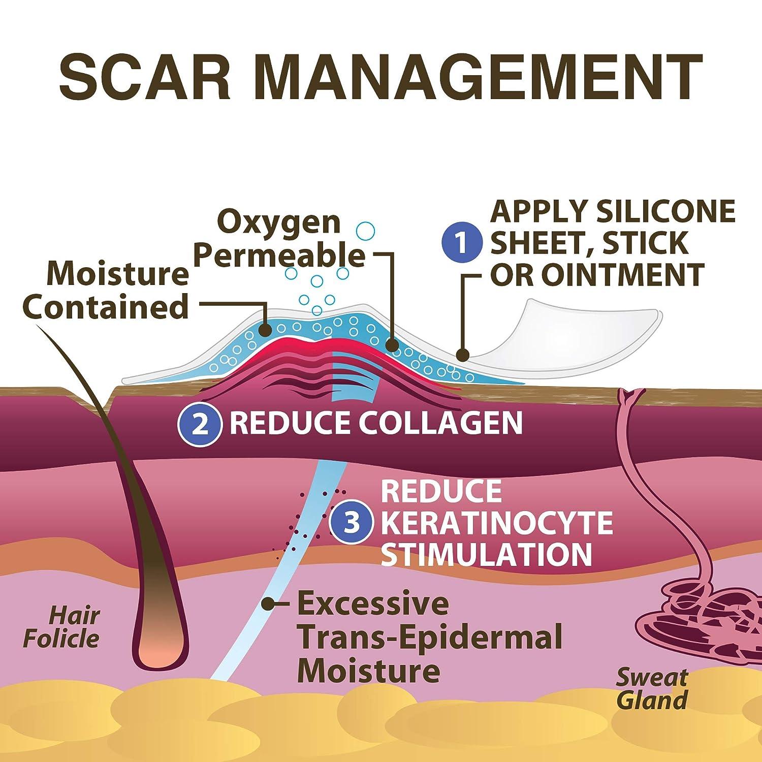 Xeragel 100 Silicone Scar Treatment Ointment Clinically Proven to
