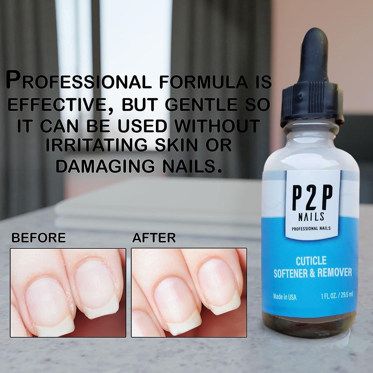 Careful Removing Of Cuticle Get Rid Of Dead Tissue Stock Photo - Download  Image Now - iStock