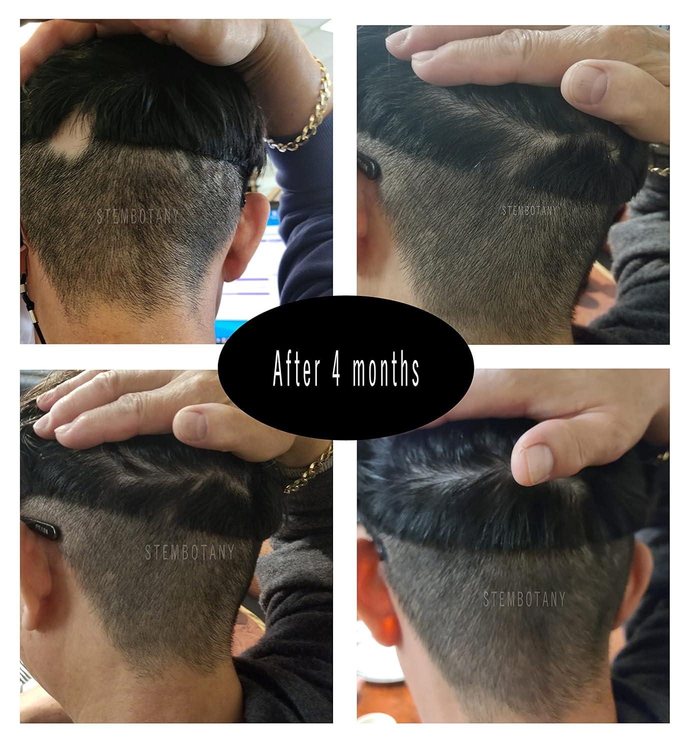 ghk cu peptide before and after hair GHK-Cu: Skin Healing, Anti-Aging, & Hair Growth Benefits