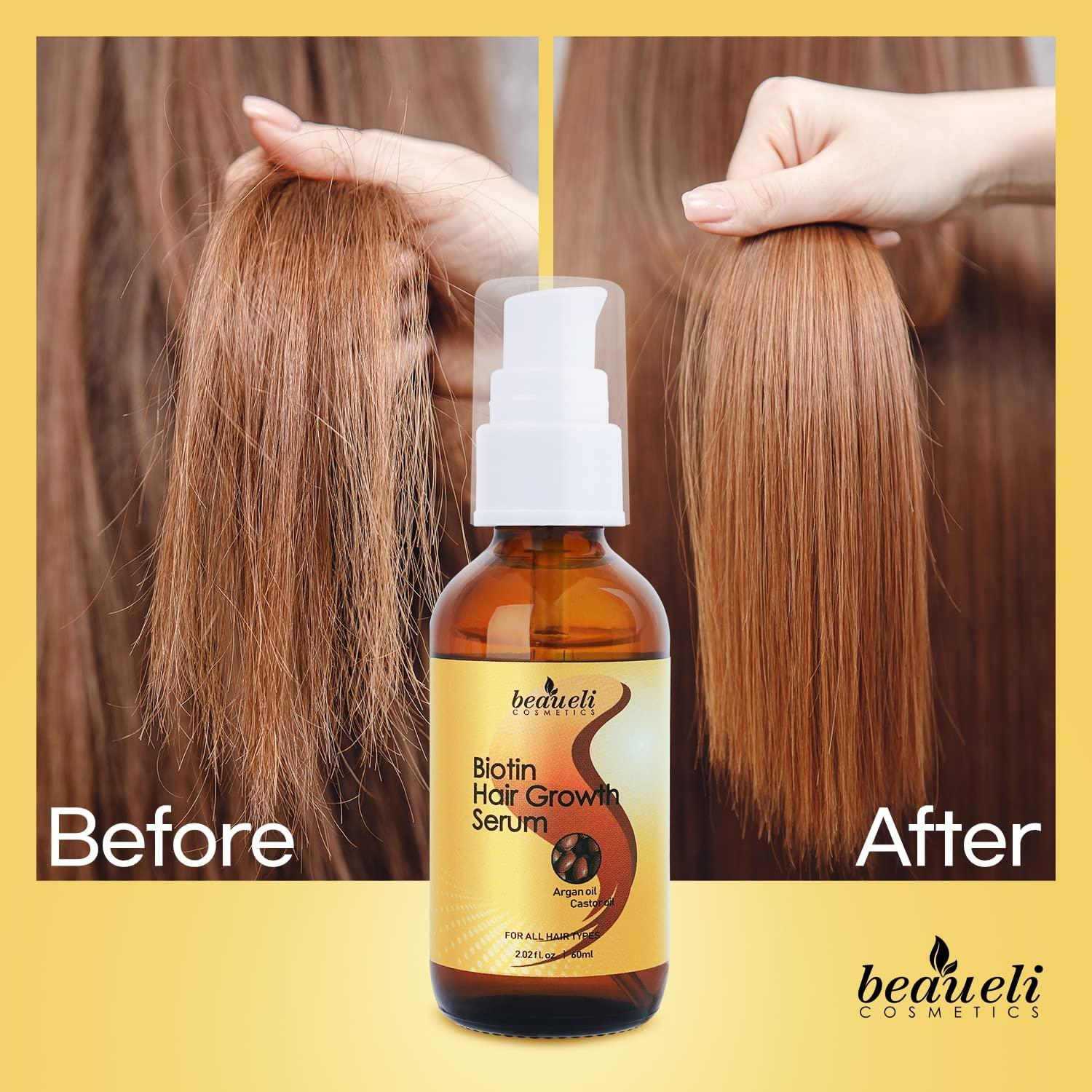 Biotin Hair Growth Serum with Castor Oil, Argan Oil - Hair Loss Prevention  Treatment with Fine Thinning Hair Formula for Men & Women By Beaueli