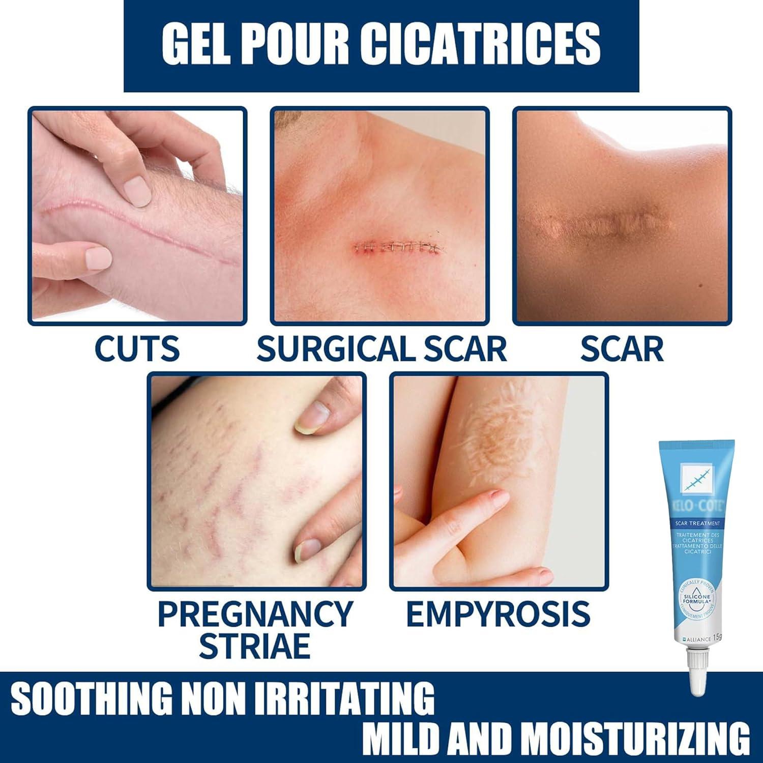 Hyundai Accent sugurta qutisi diagrammasi Onlayn shifokor pornoga viruslarsiz tashrif buyuradi