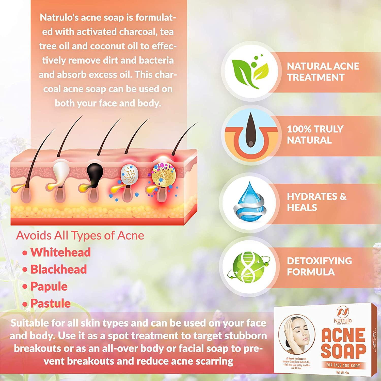 Natrulo Acne Bar Soap with Activated Charcoal & Bentonite Clay Black