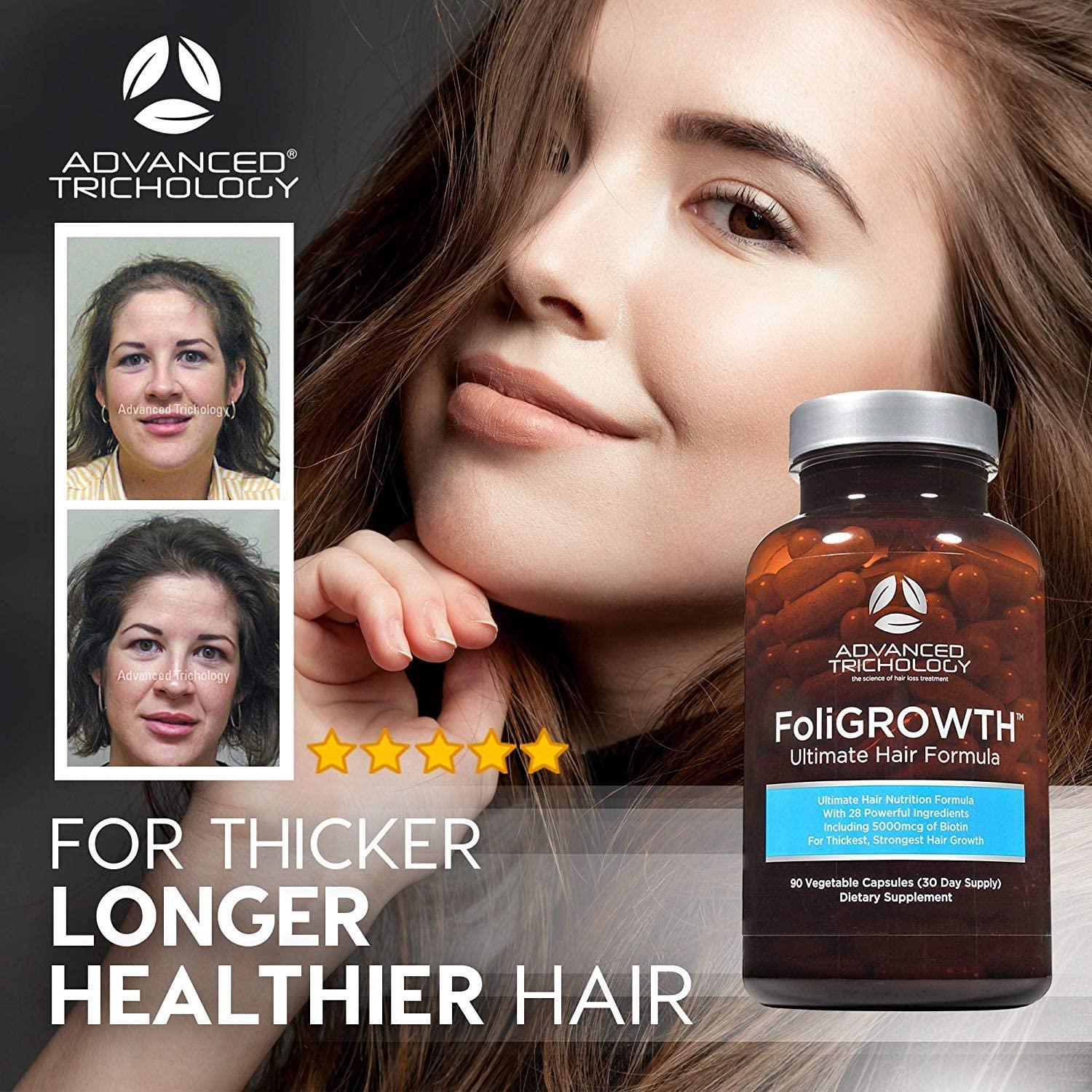 FoliGROWTH Hair Growth Supplement for Thicker Fuller Hair | Approved* by  the American Hair Loss Association | Revitalize Thinning Hair, Backed by 20  Years of Experience in Hair Loss Treatment Clinics