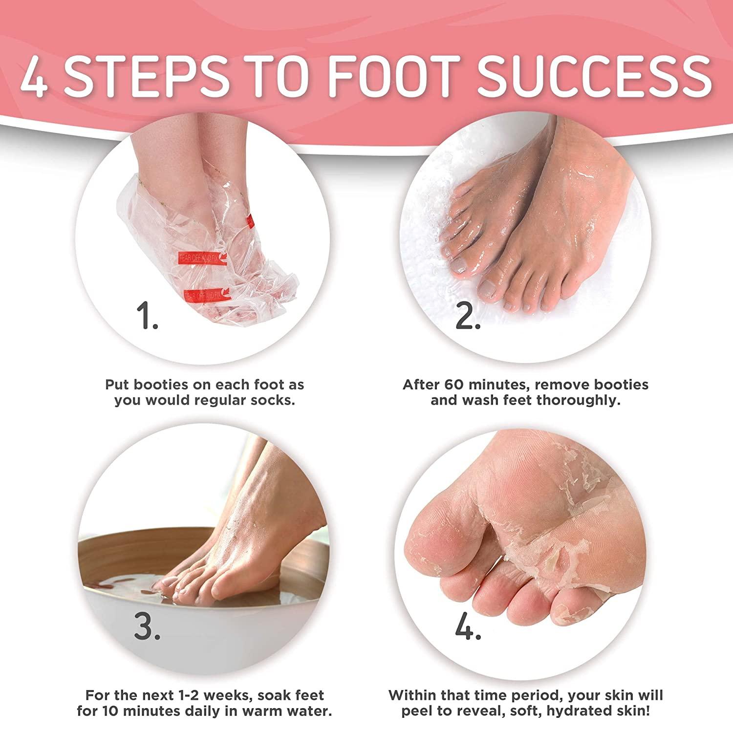Cracked heel discount peel off
