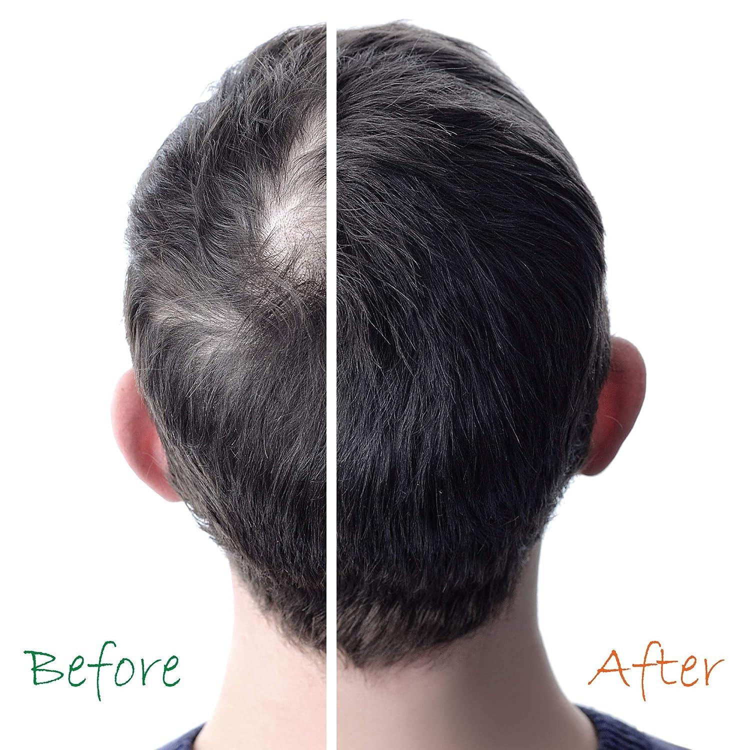 Organic Hair Energizer Root & Scalp Pro VitaminB5 Hair Growth Tonic 1.