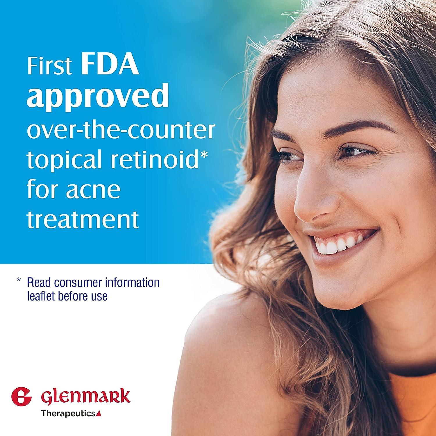 Glenmark Adapalene Gel 0.1 Acne Treatment Topical Retinoid Cream