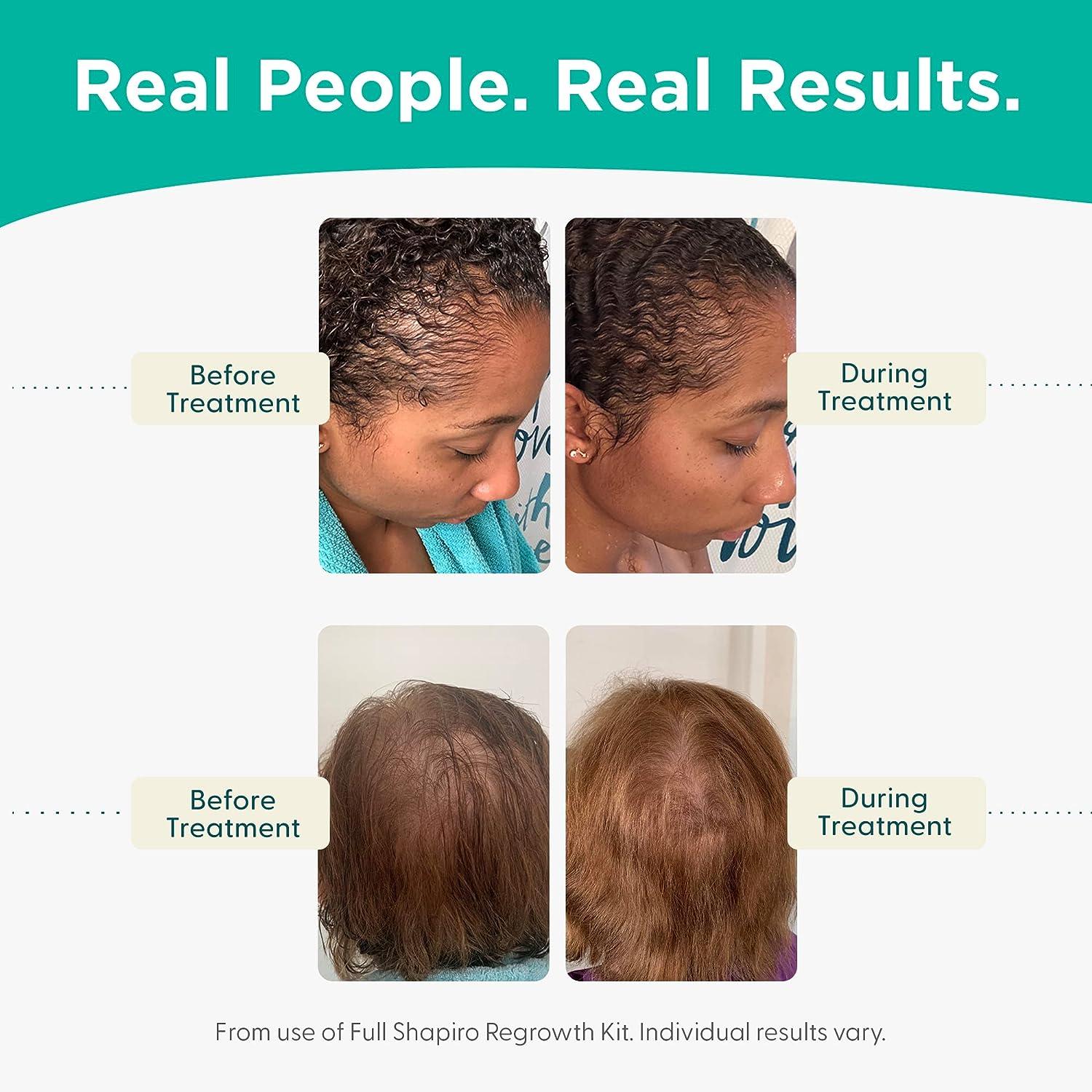 Good Hair Women Anti-hair loss - 1 month