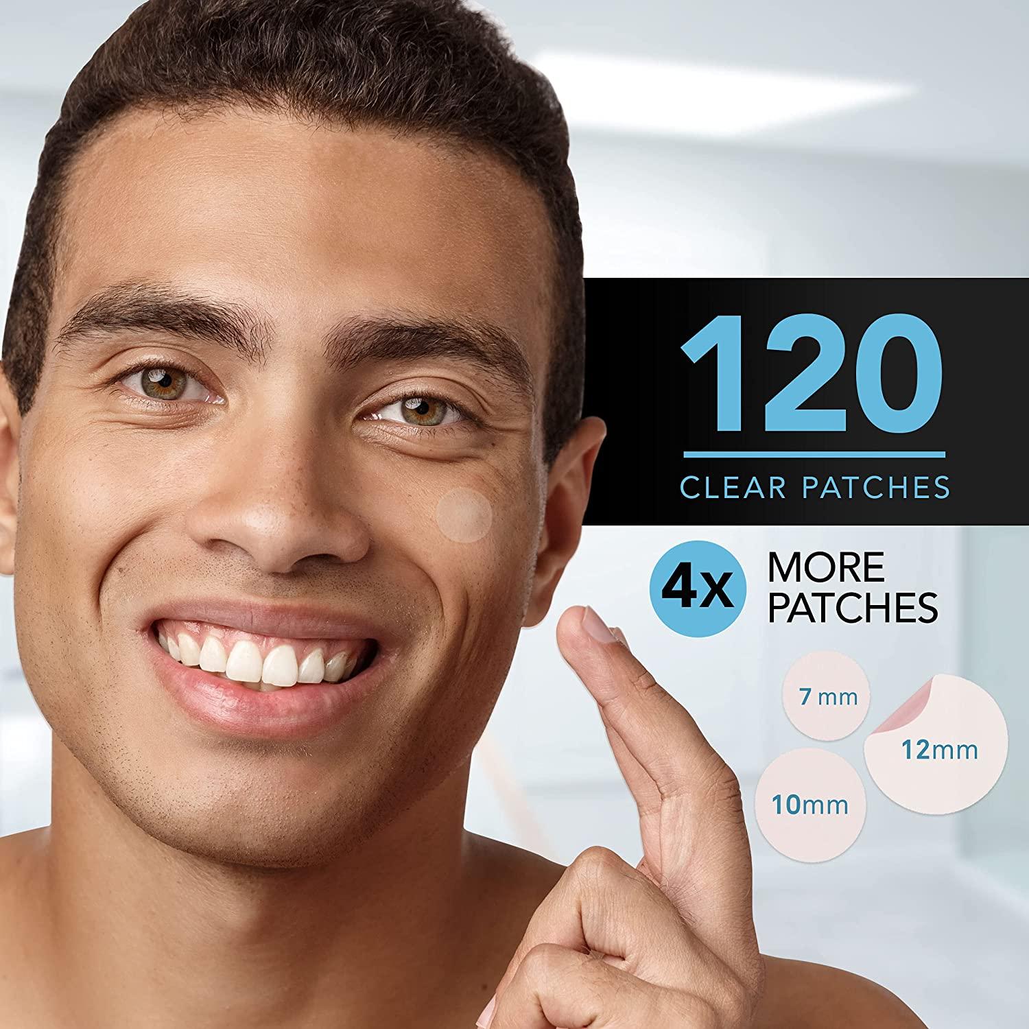 Acne Patches (120 Count) with Tea Tree Oil, Hydrocolloid Pimple Patches