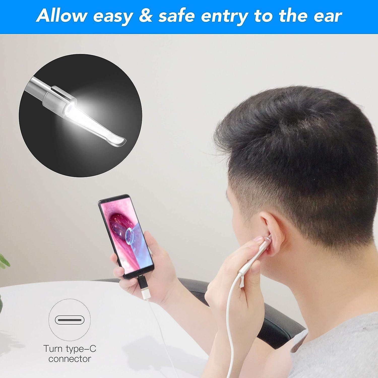 Digital LED Otoscope Ear Camera Scope Remover Cleaning Tool USB Inspection  Camera Endoscope - China Digital Otoscope Ear Spoon, Ear Camera