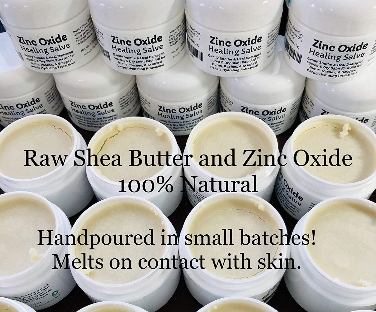 Urban ReLeaf Zinc Oxide Salve ! Gently Soothe & Heal Damaged, Injured