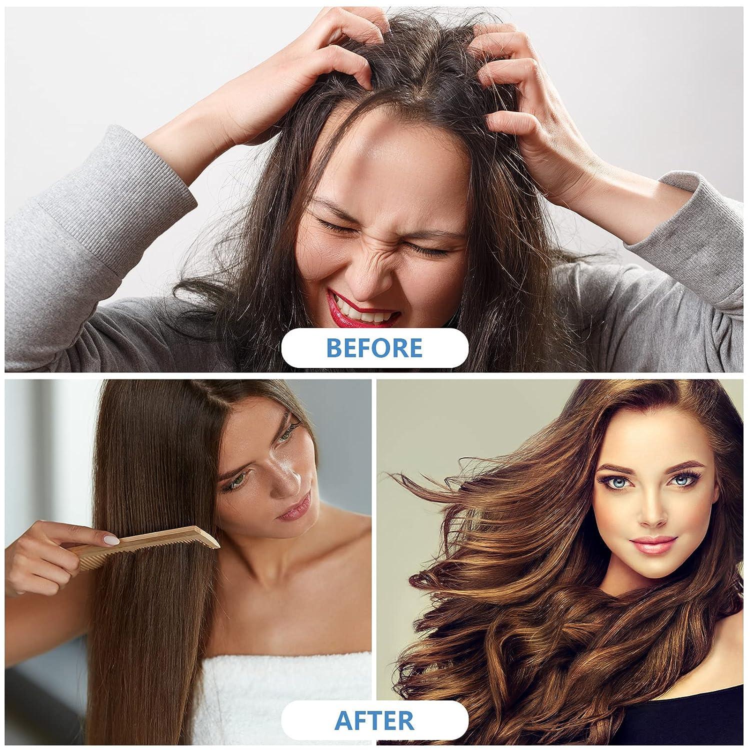 15 Pcs Waterless Shampoo Caps for Women Rinse Free & Microwaveable