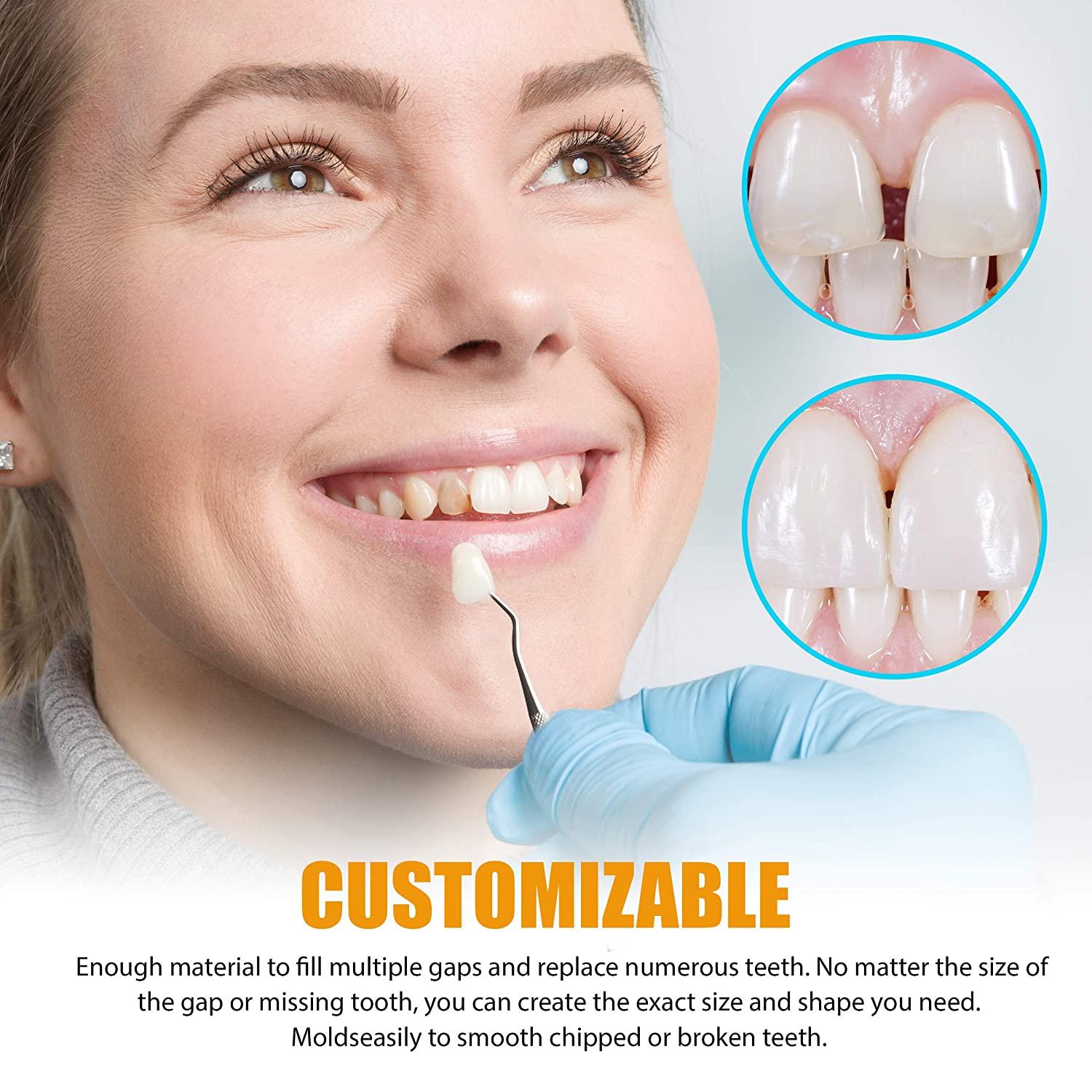 DIY Gap Eliminator Temporary Tooth Substitute Kit with Sculpting Tool