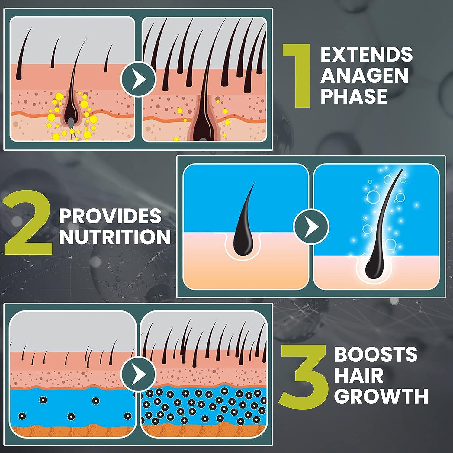 Minoxidil Booster Spray for Hair Loss - Enhances Absorption 7X for  Non-Responders with Low SULT1A1 Enzyme Levels