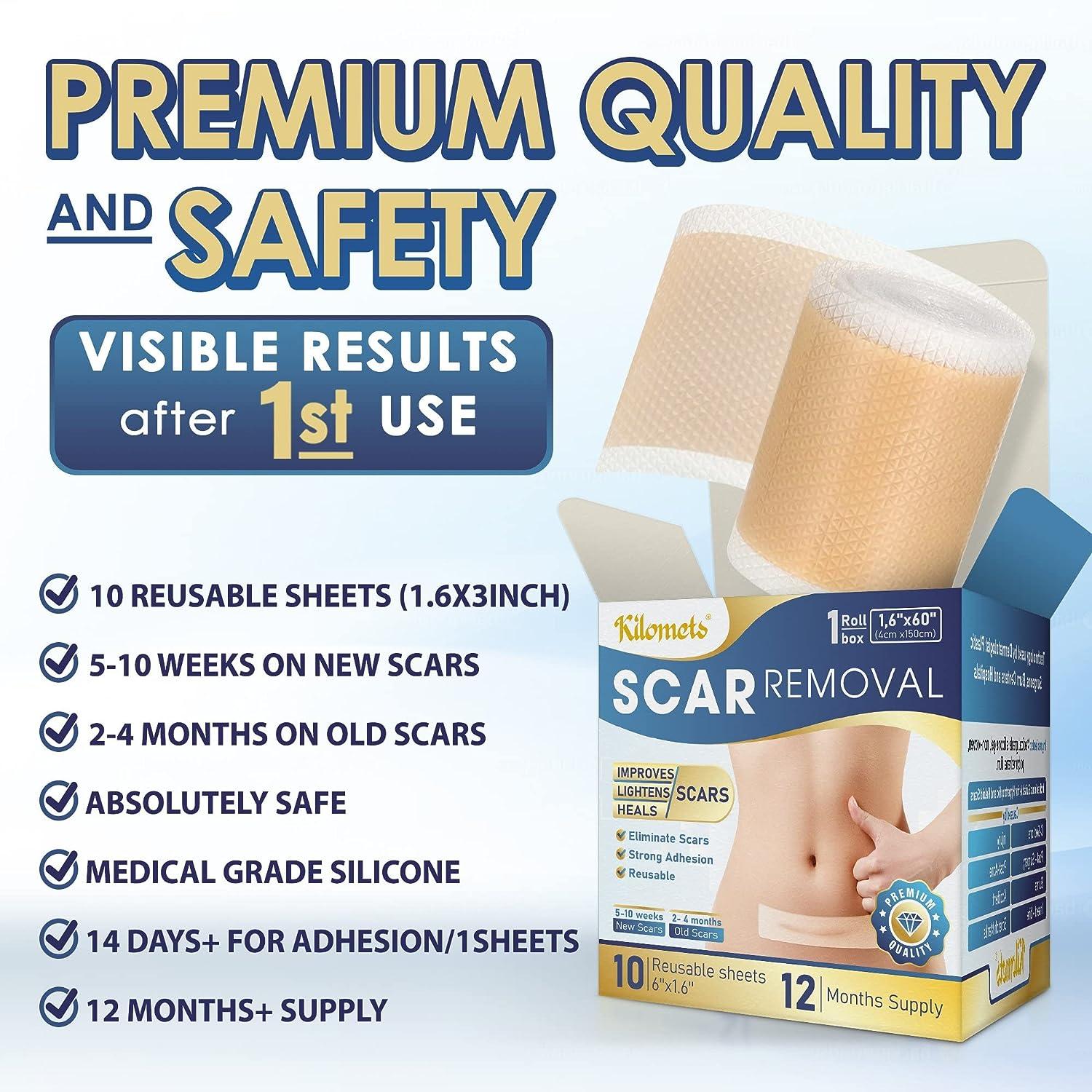 Silicone Scar Sheets (1.6 x 601.5M) Scar Removal Gel Tape Keloids C